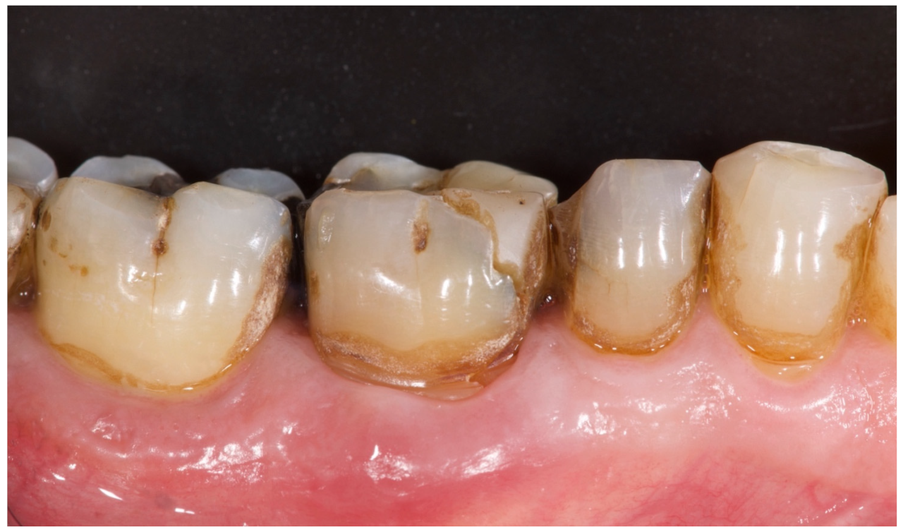 Materials 15 00254 g001