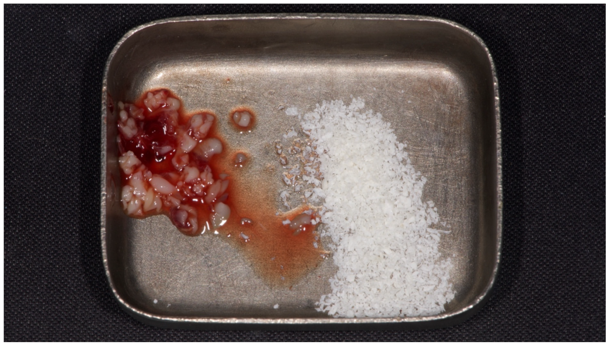 Materials 15 00254 g003