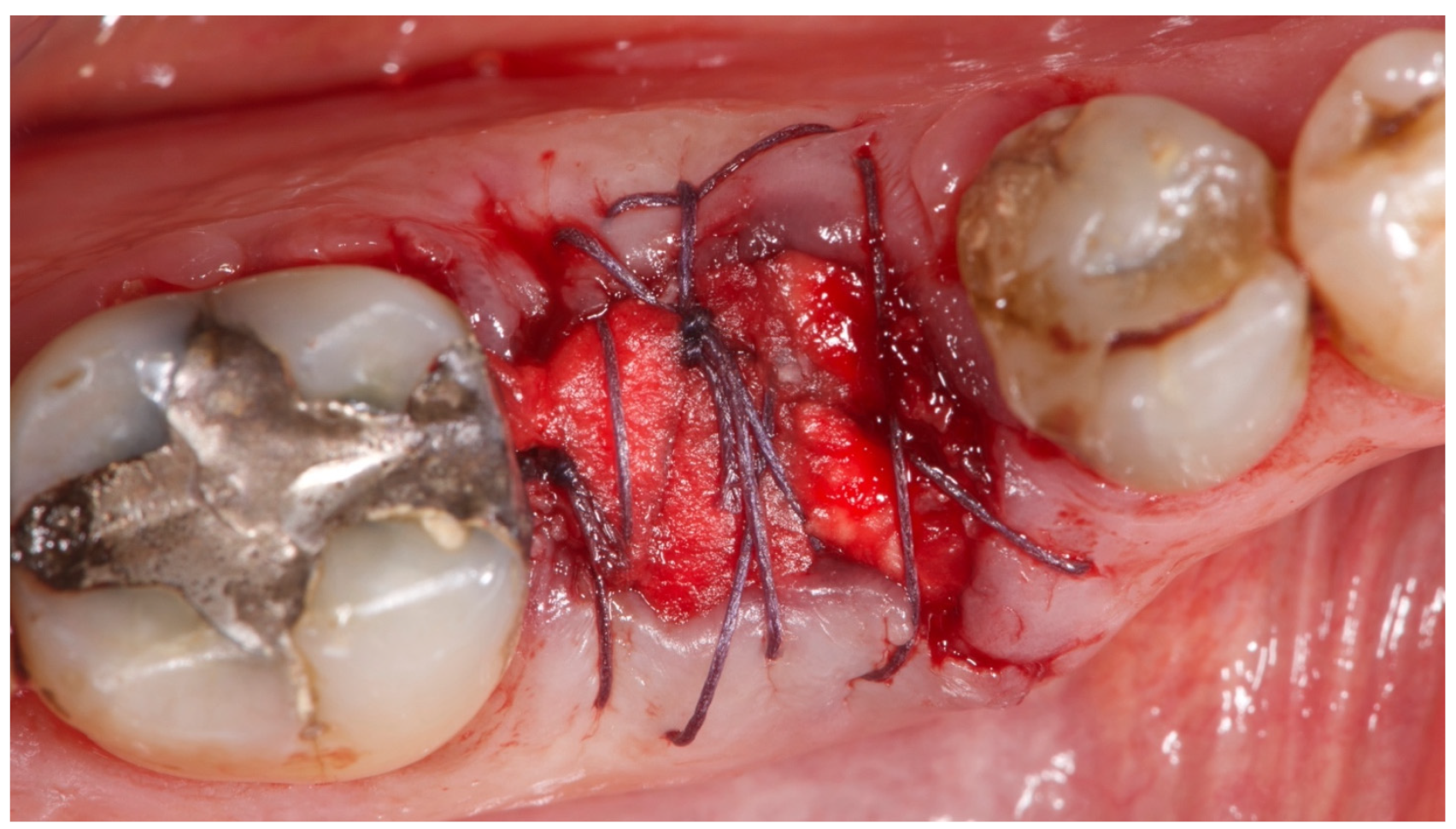 Materials 15 00254 g006