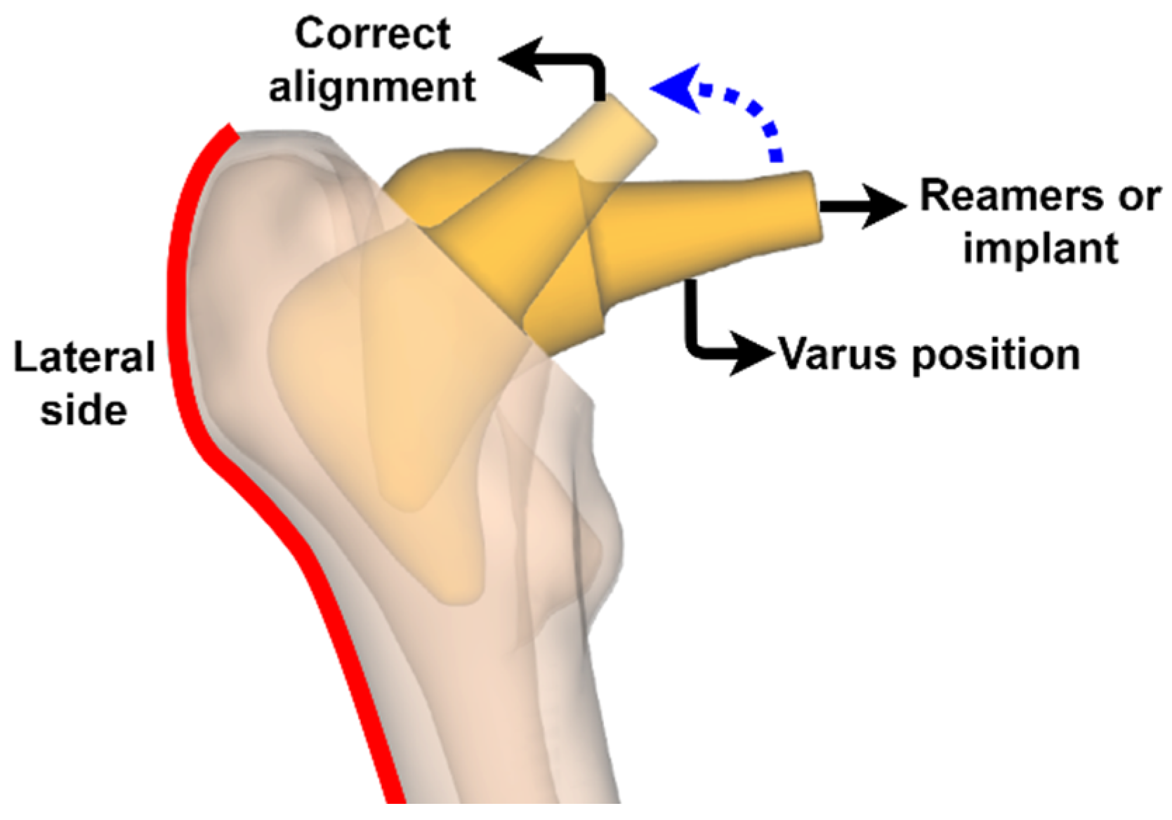 Materials 15 00442 g006 Materials 15 00442 g006