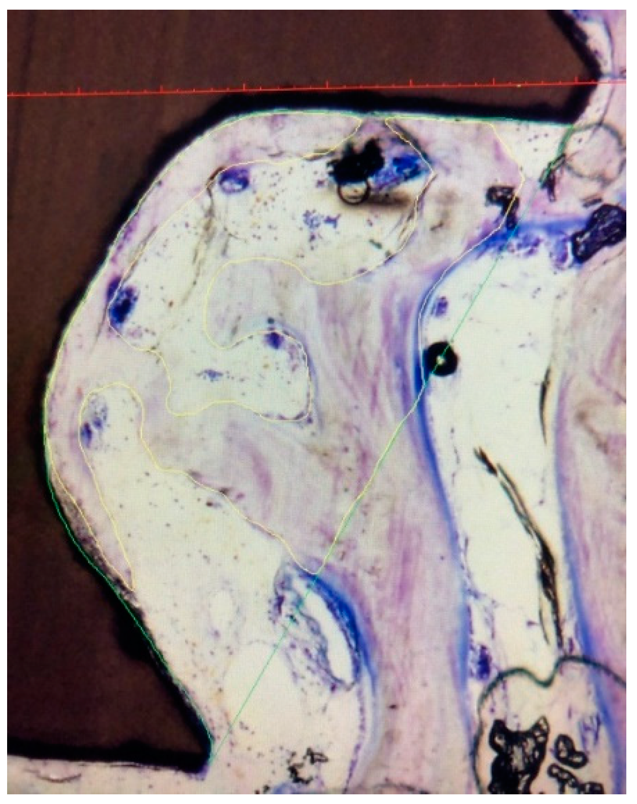 Materials 15 00496 g004