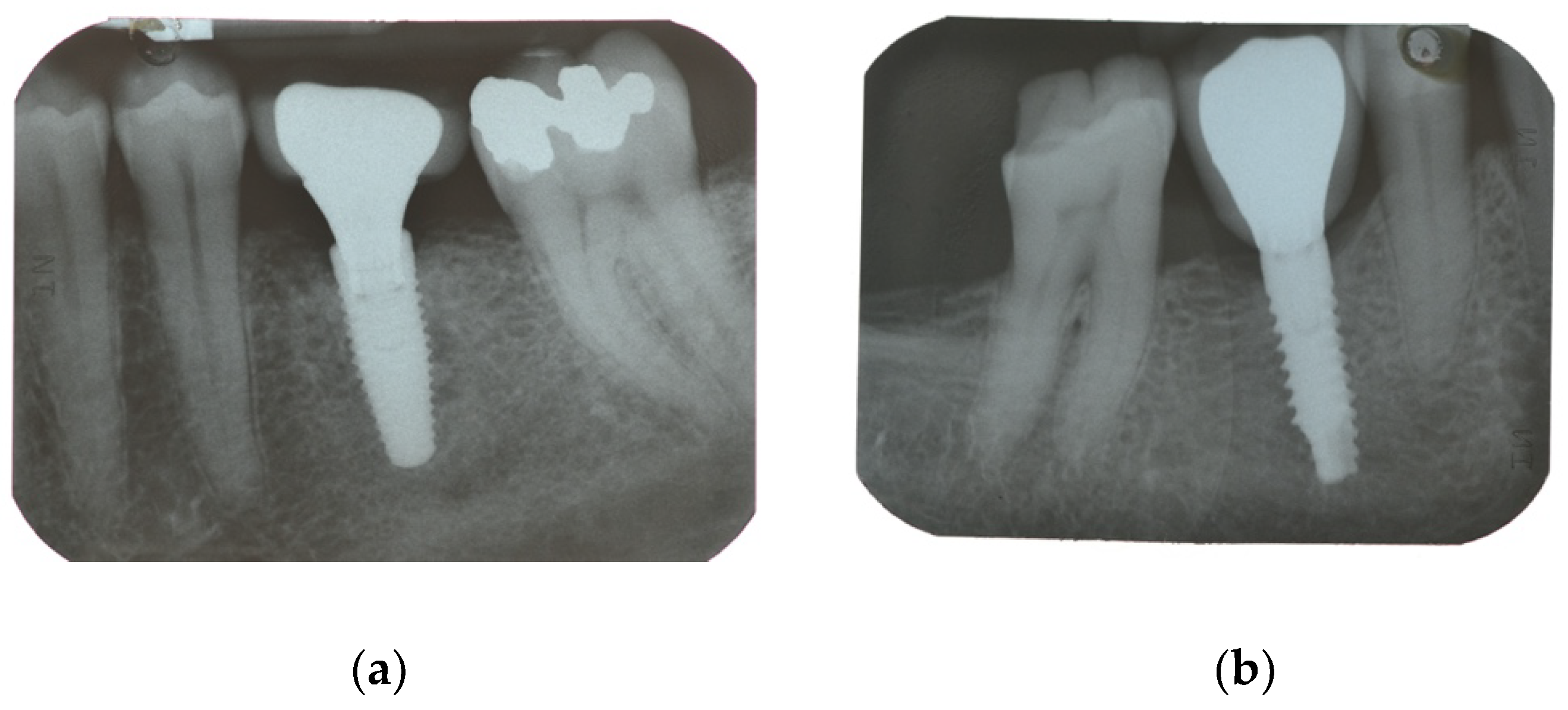 Materials 15 00511 g002 550