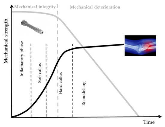 Fluoride Treatment and In Vitro Corrosion Behavior of Mg-Nd-Y-Zn