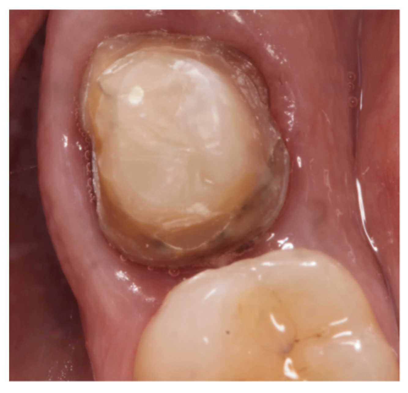 Materials 15 00672 g001 Materials 15 00672 g001