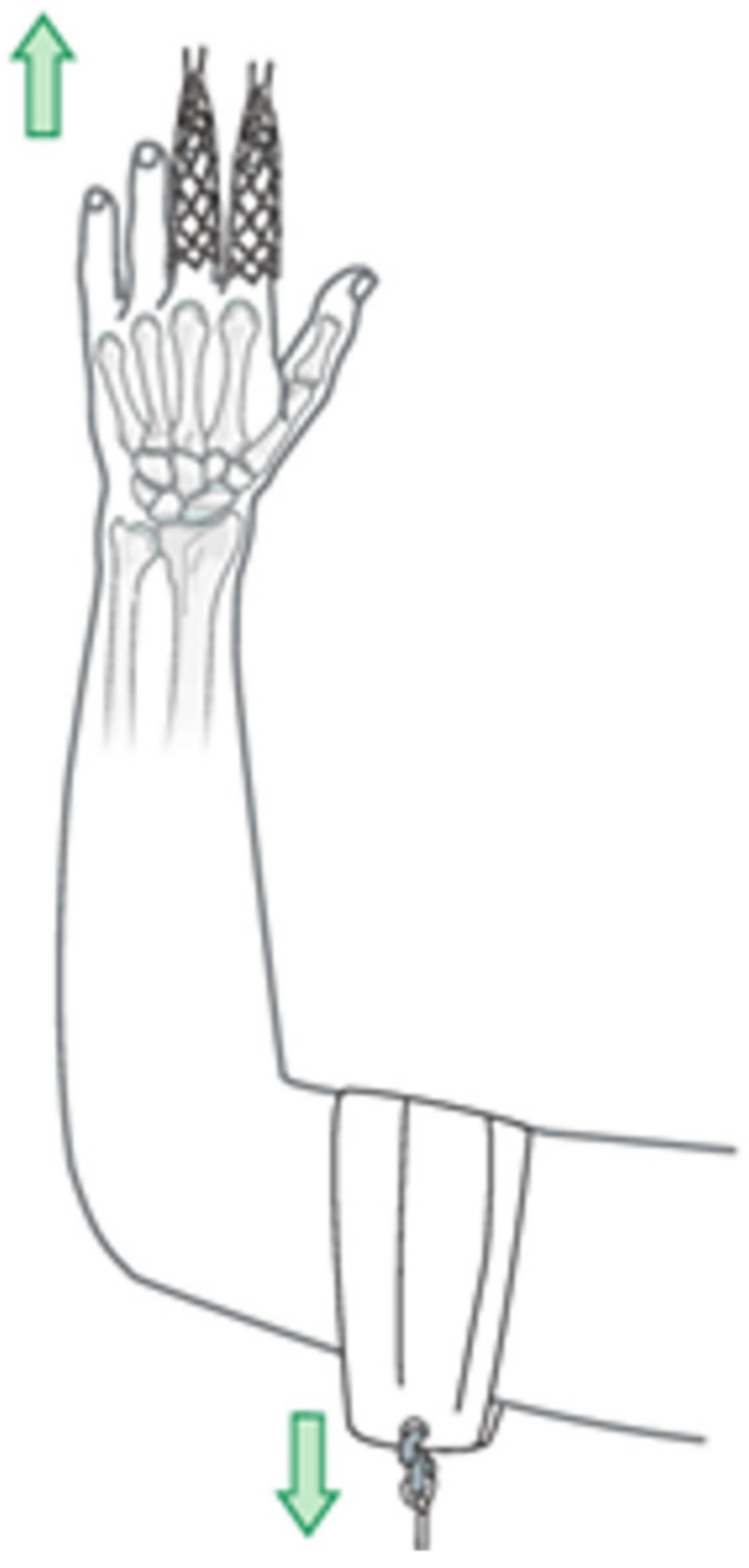 Materials 15 00694 g001