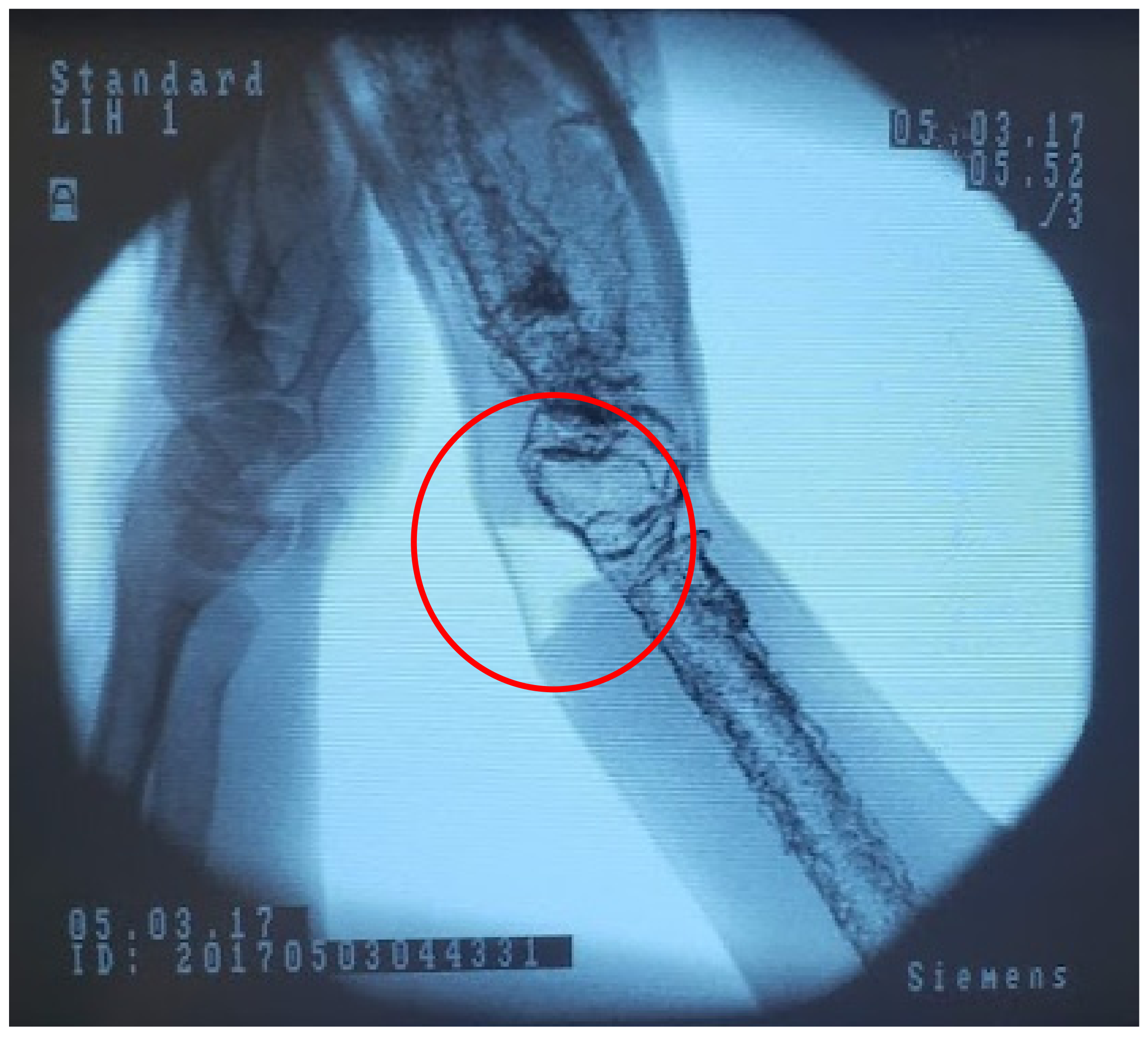 Materials 15 00694 g011