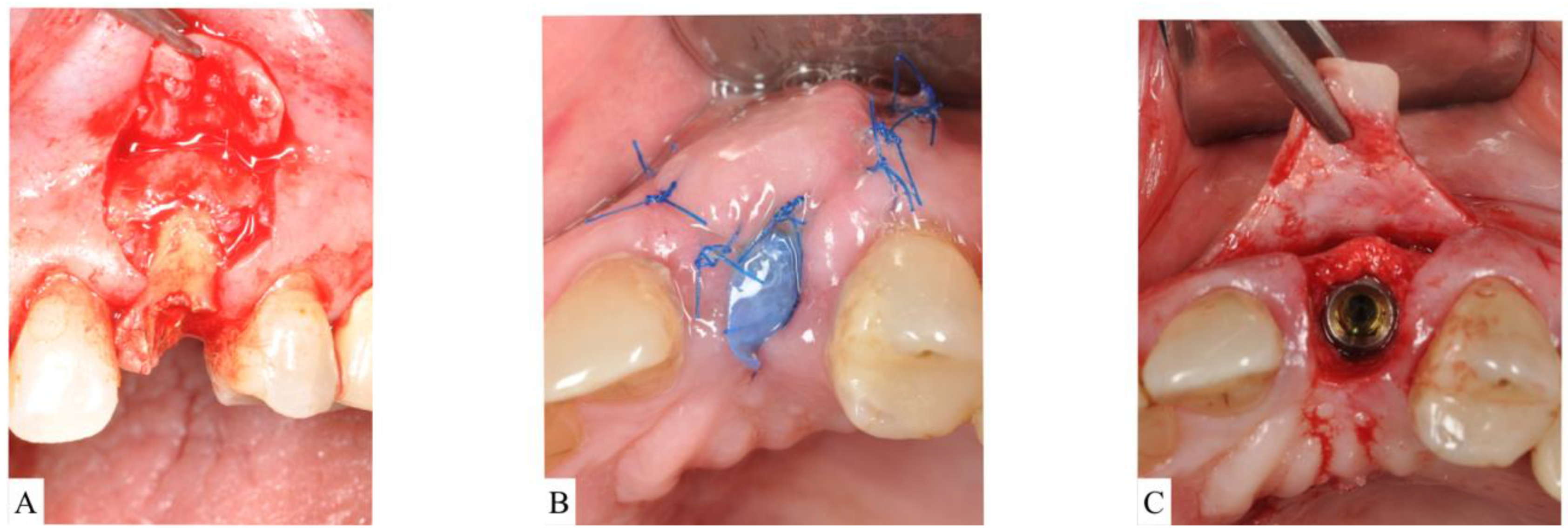 Materials 15 00733 g005 550