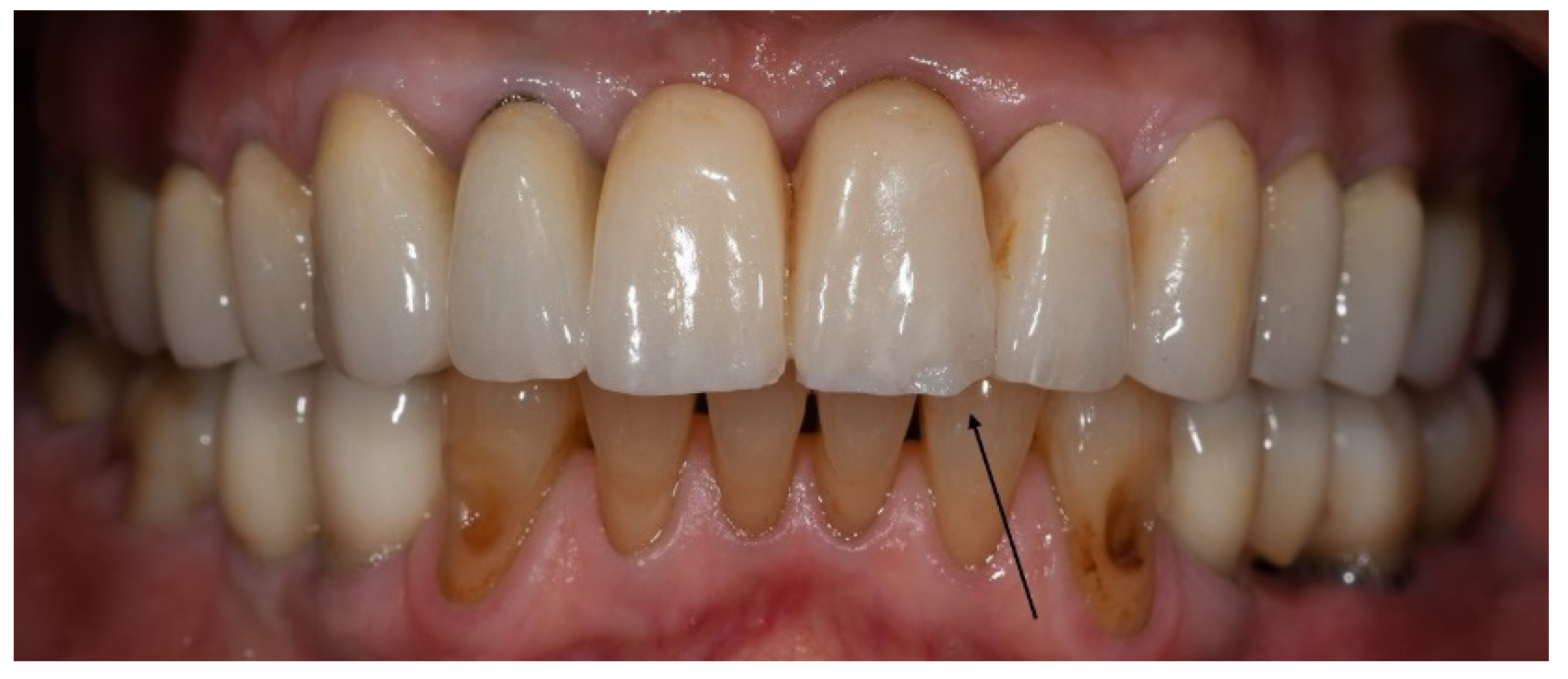 Materials 15 00833 g002 550