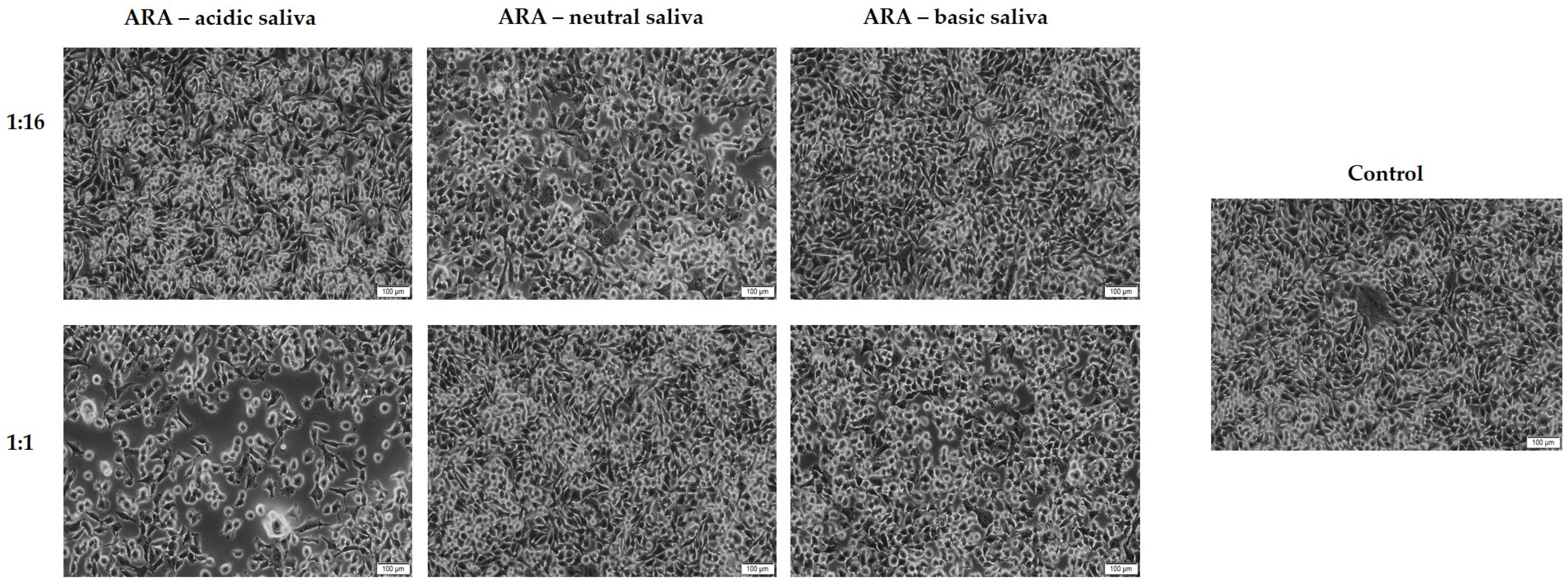 Materials 15 01193 g006
