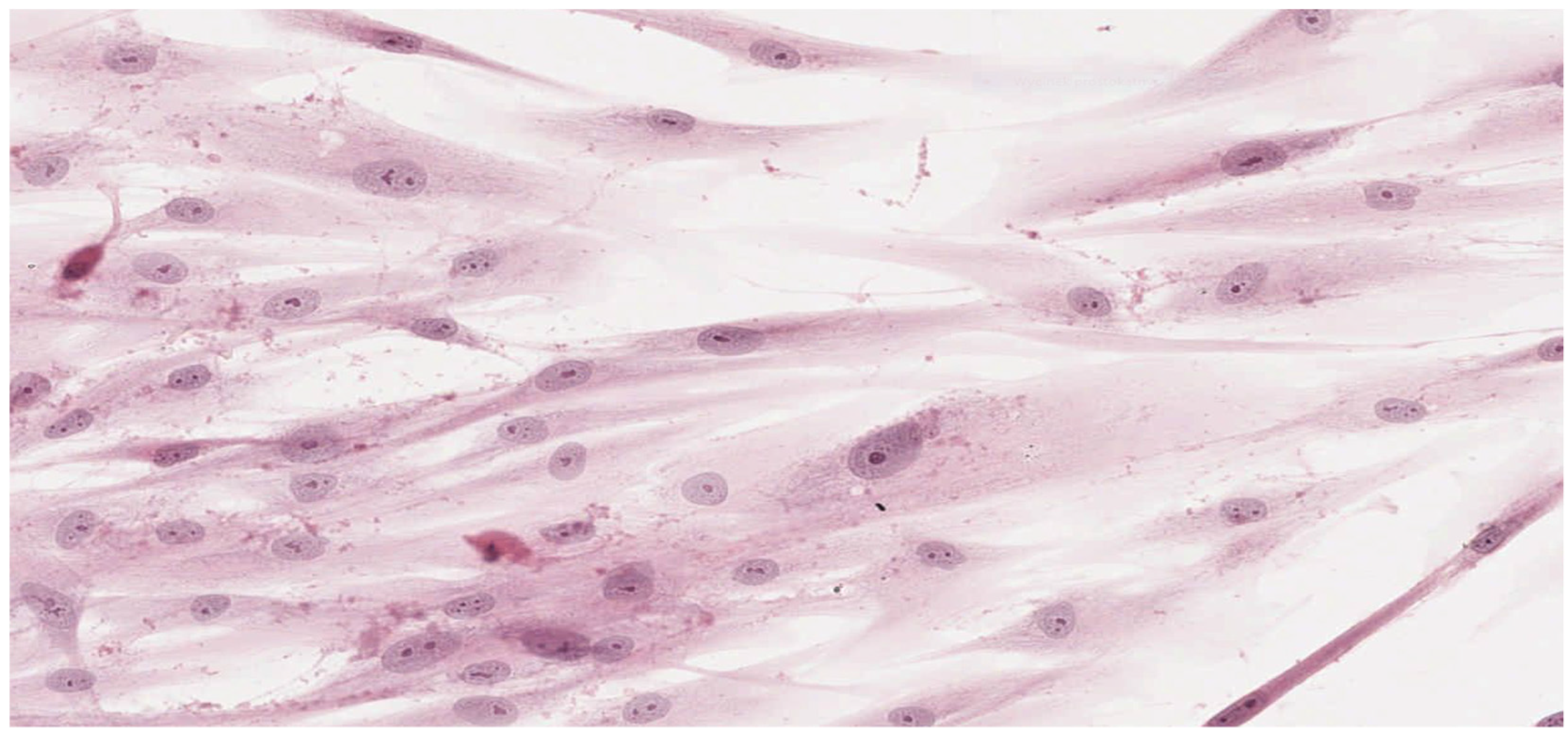 Materials 15 01583 g004