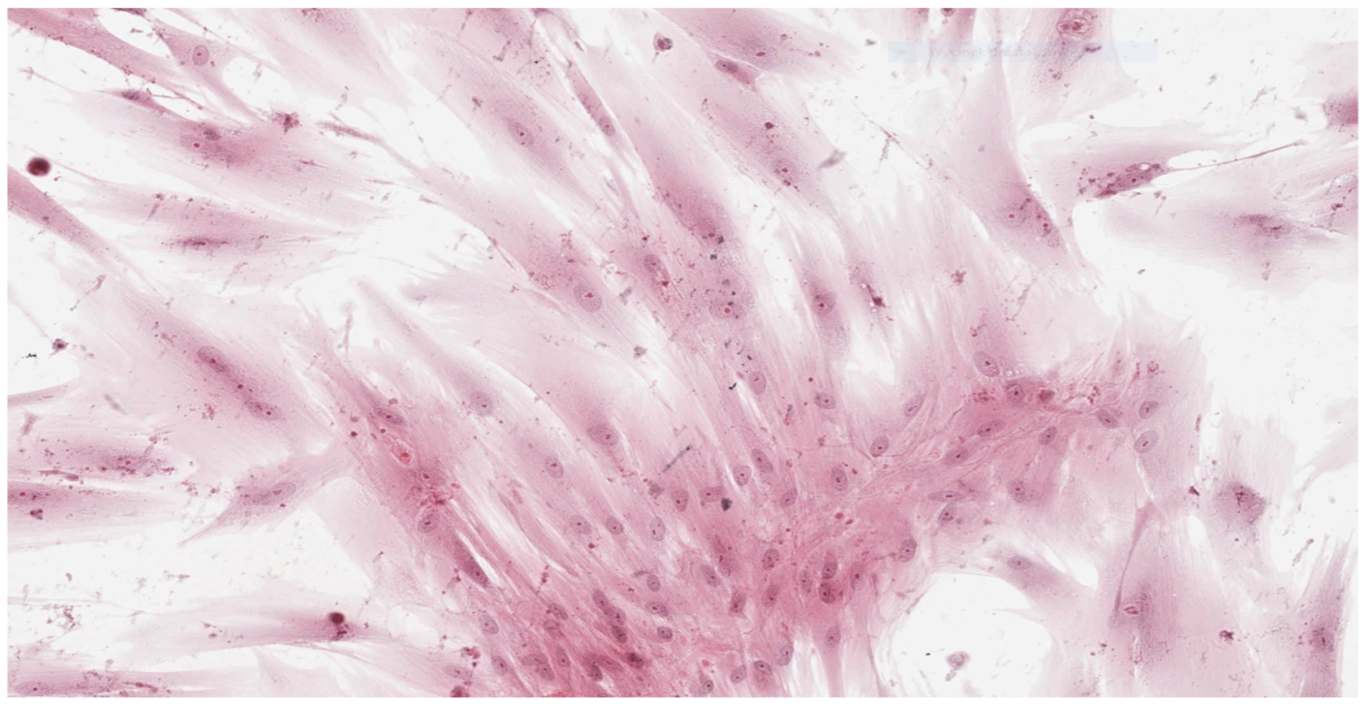 Materials 15 01583 g005