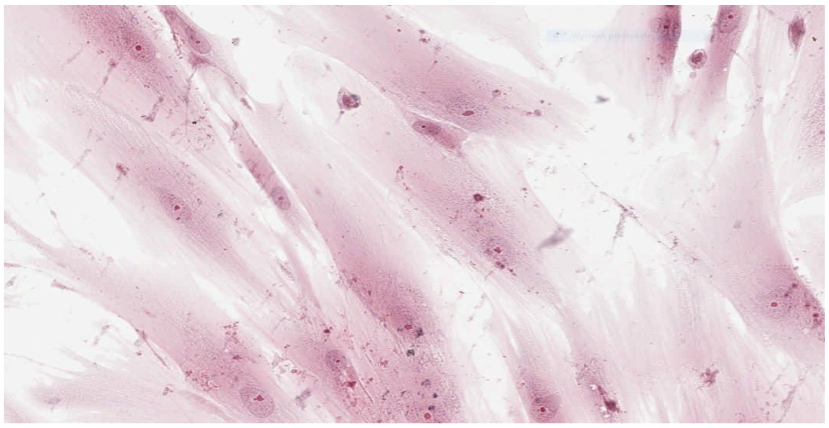 Materials 15 01583 g006