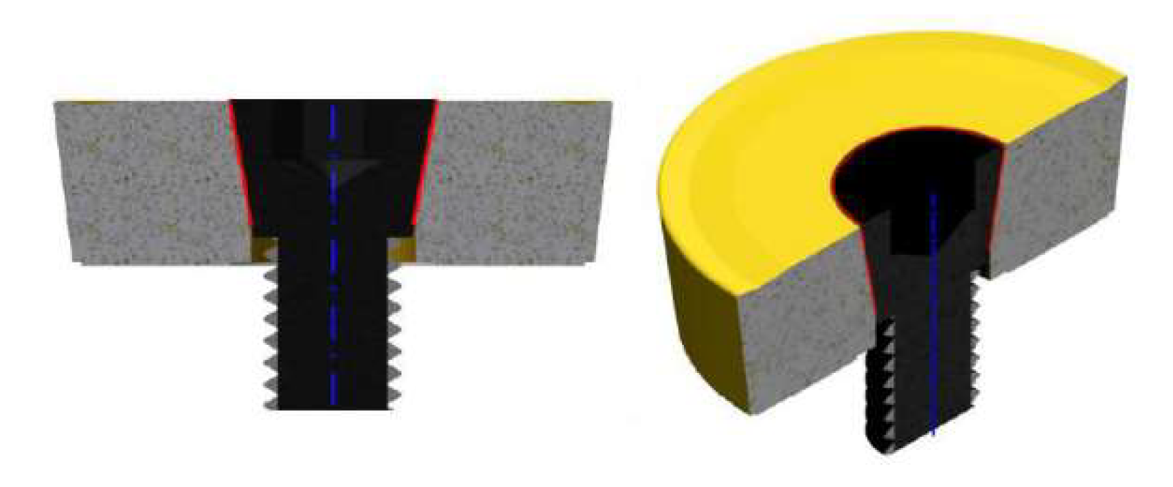 Materials 15 01630 g004 Materials 15 01630 g004