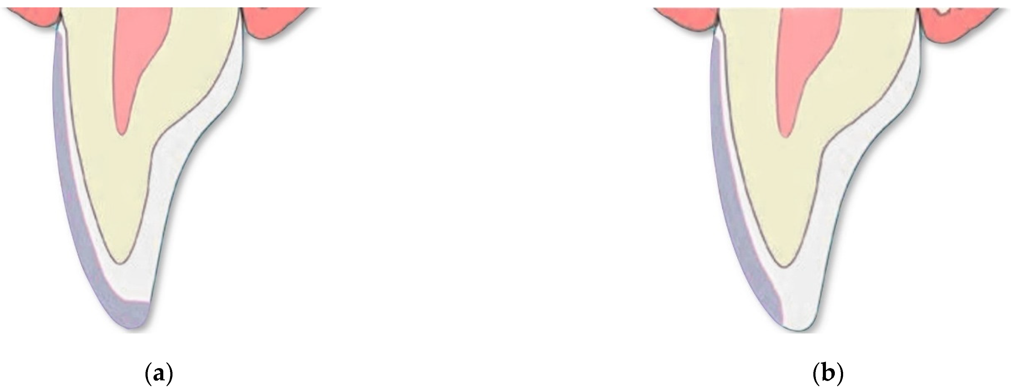 Materials 15 01763 g003