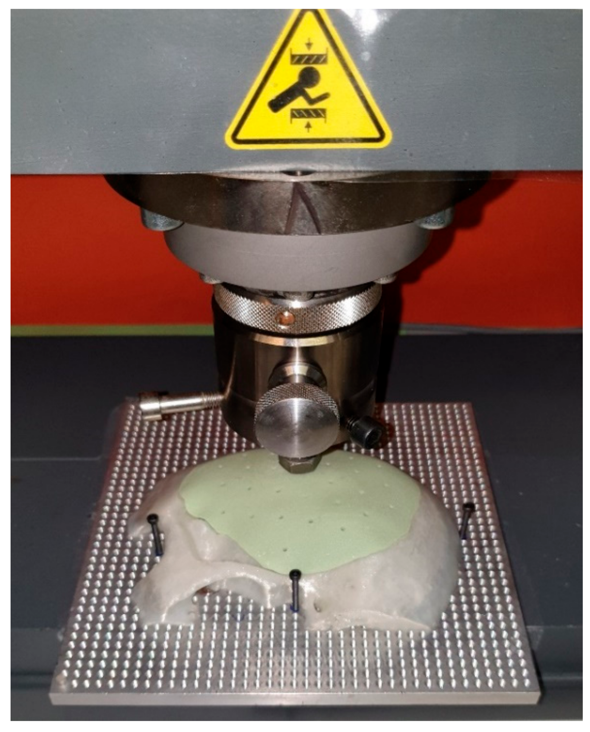 Materials 15 01970 g009