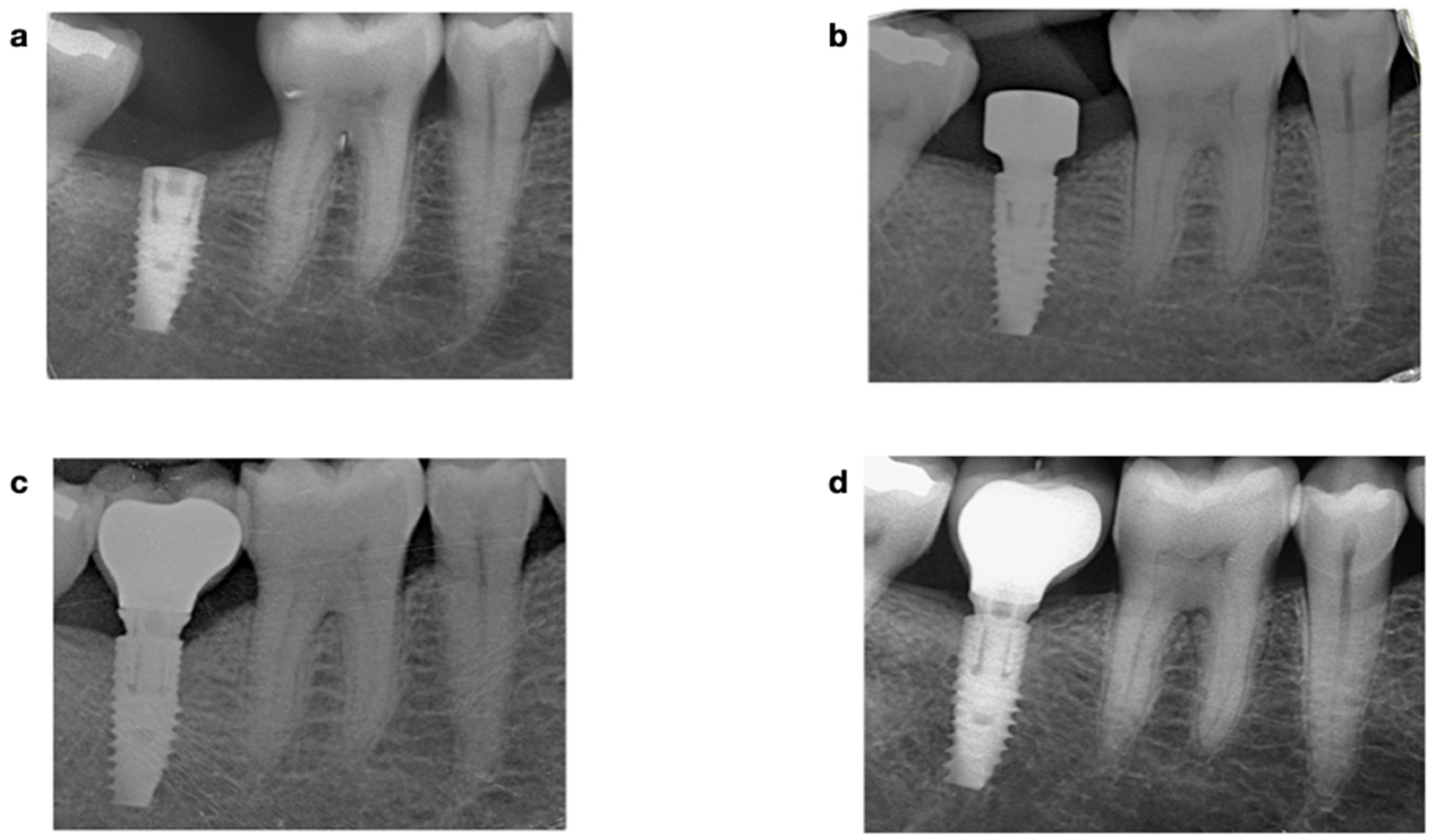 Materials 15 01987 g001 550