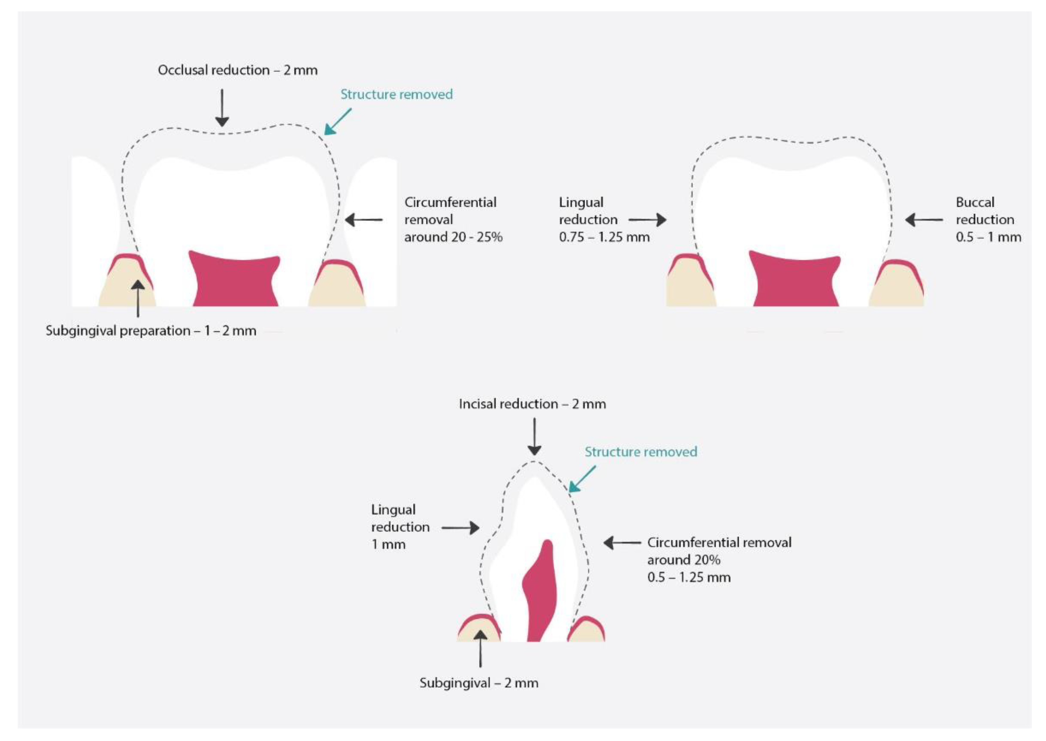 Materials 15 02081 g008 550