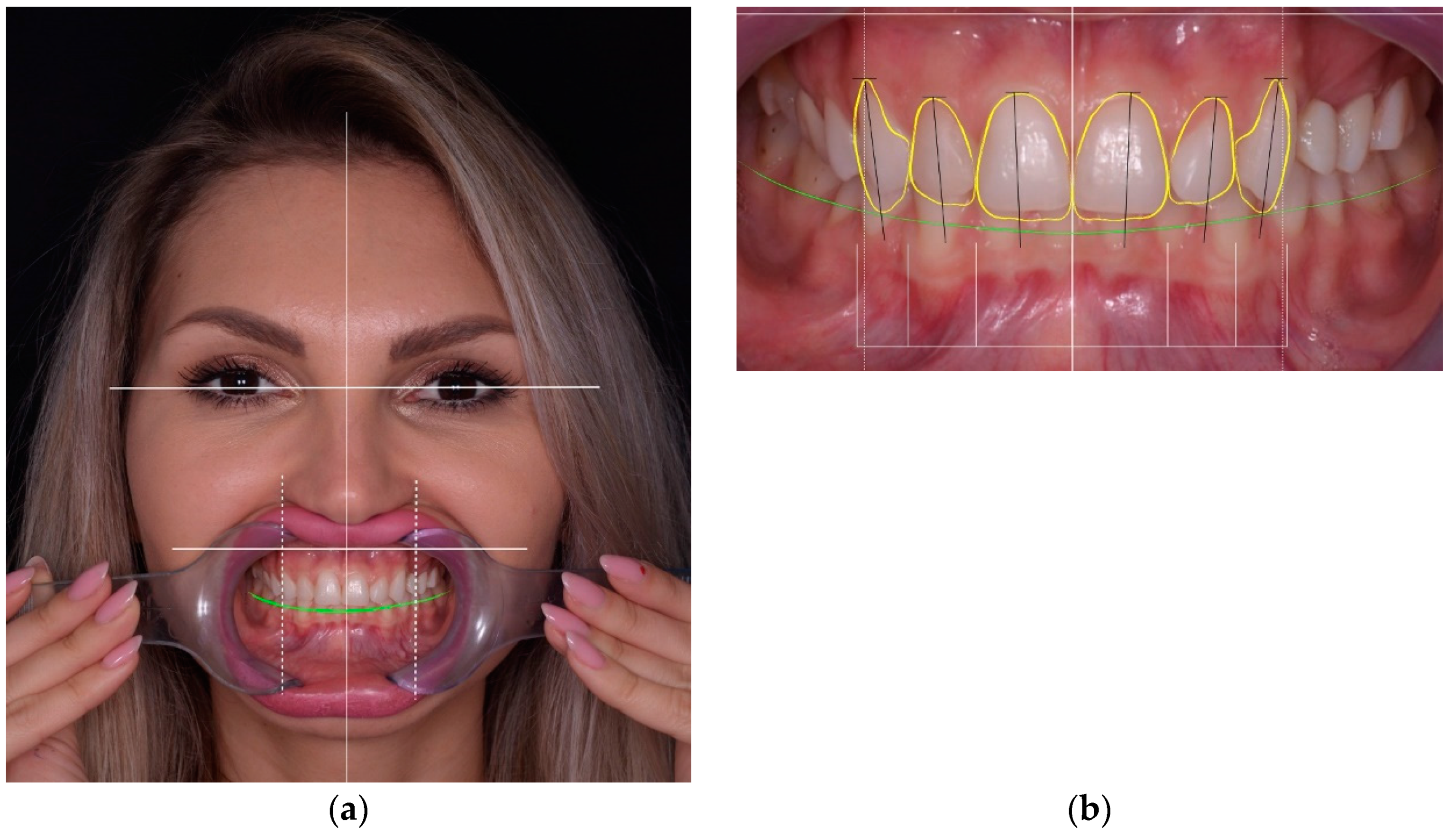 Materials 15 02150 g001