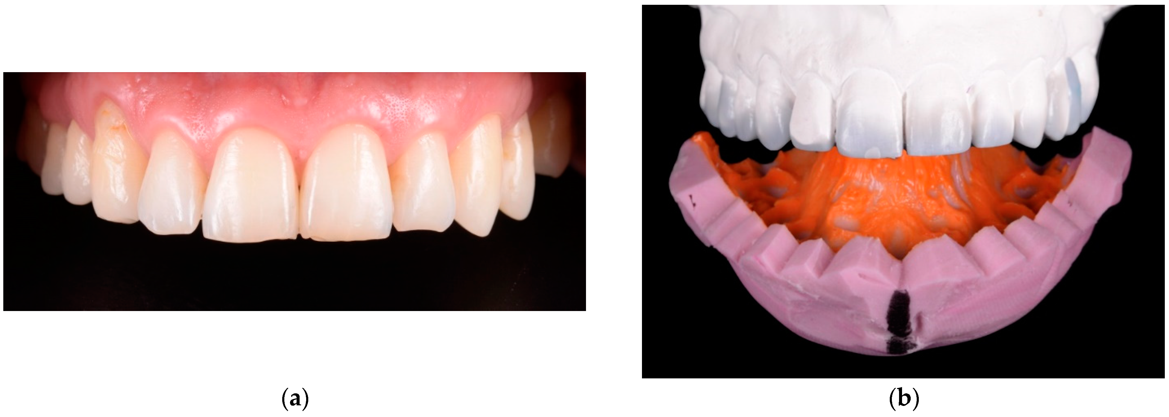 Materials 15 02150 g003a