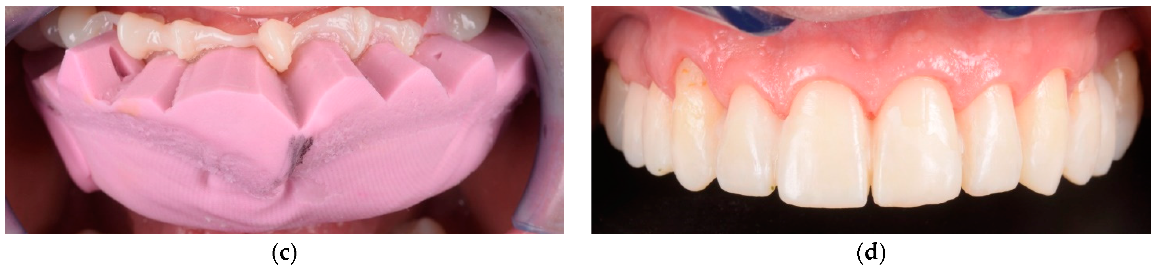 Materials 15 02150 g003b