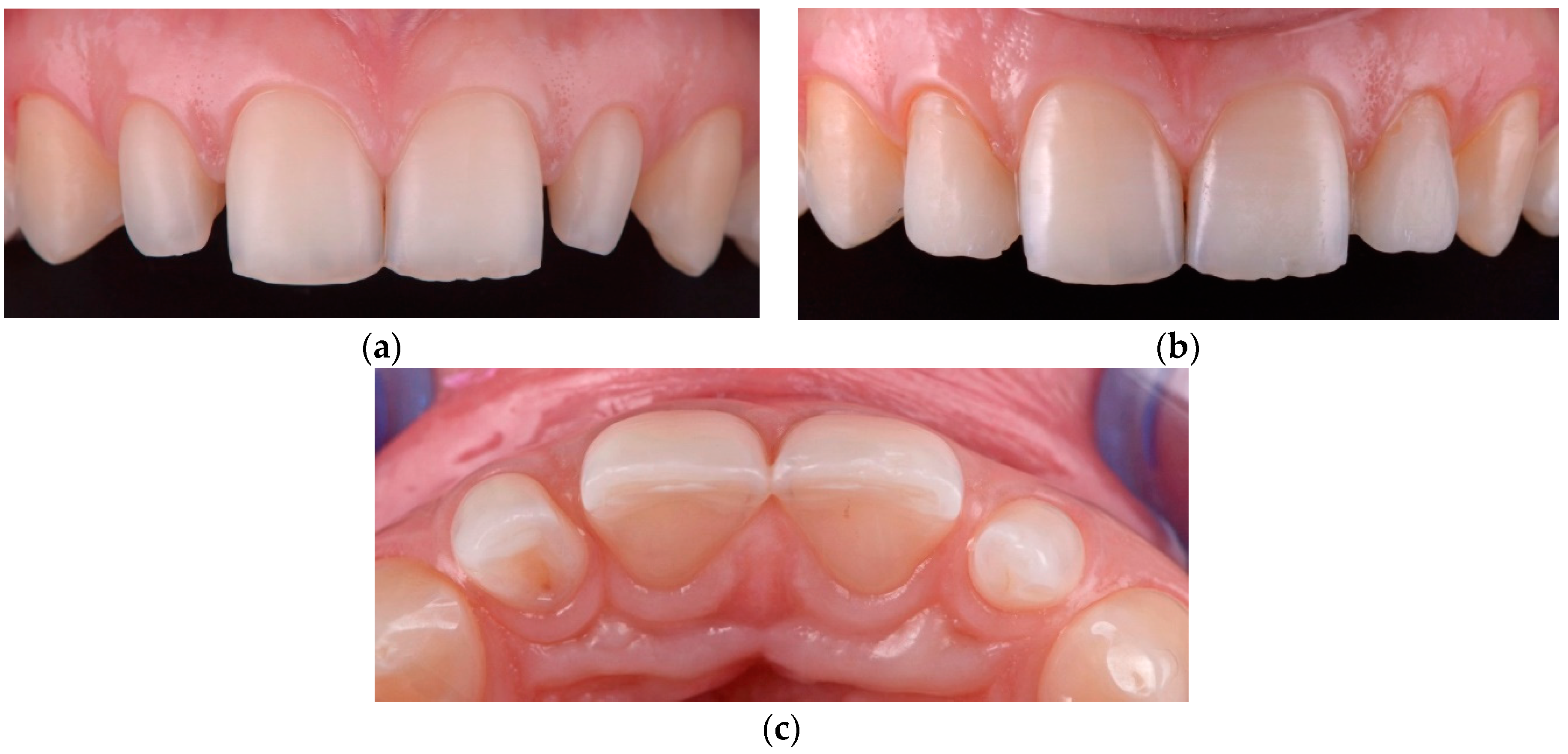 Materials 15 02150 g004