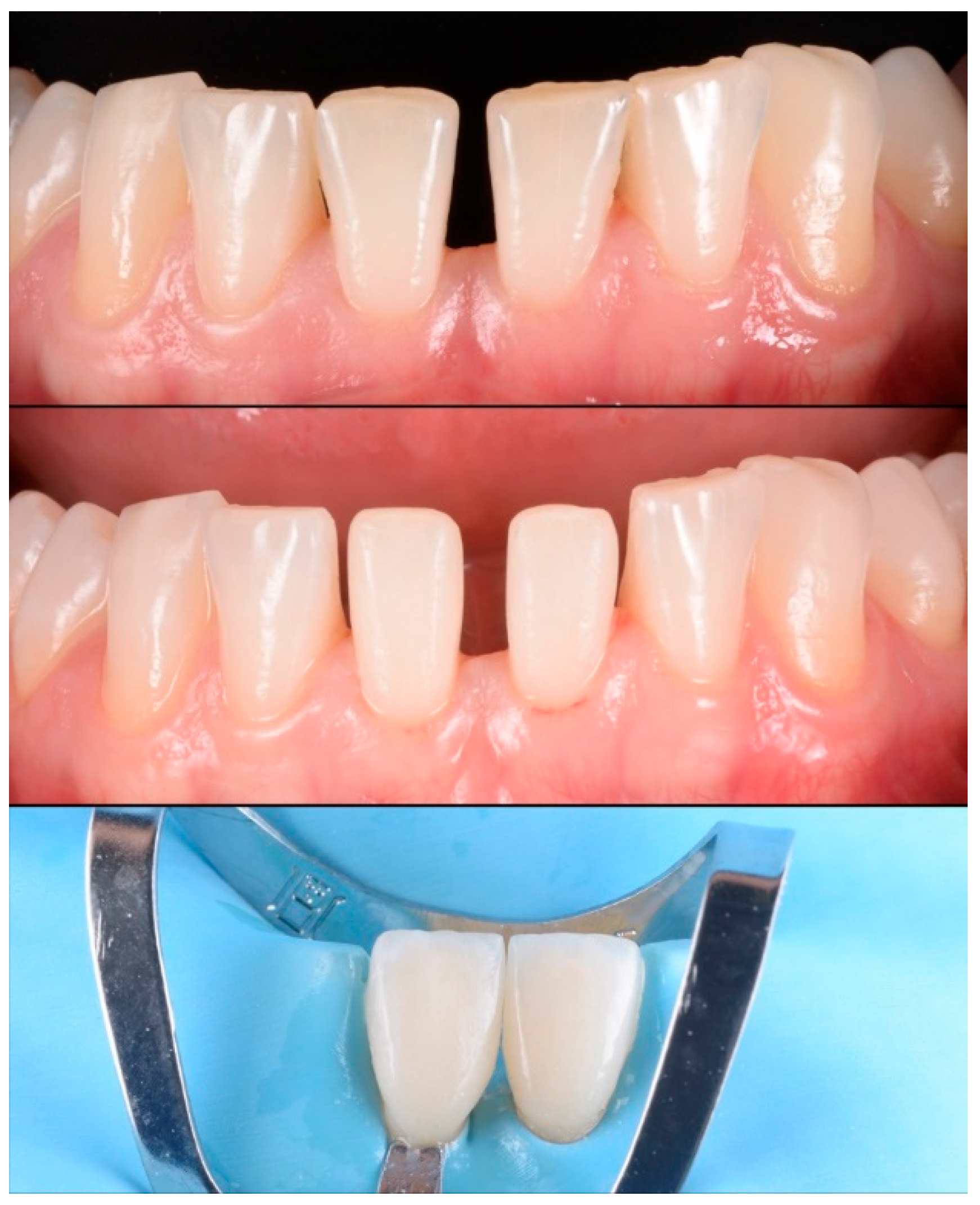 Materials 15 02150 g006