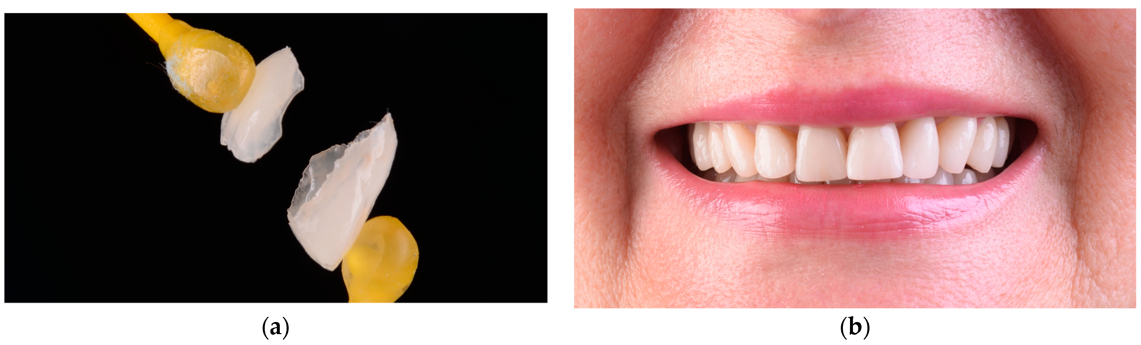 Materials 15 02150 g007