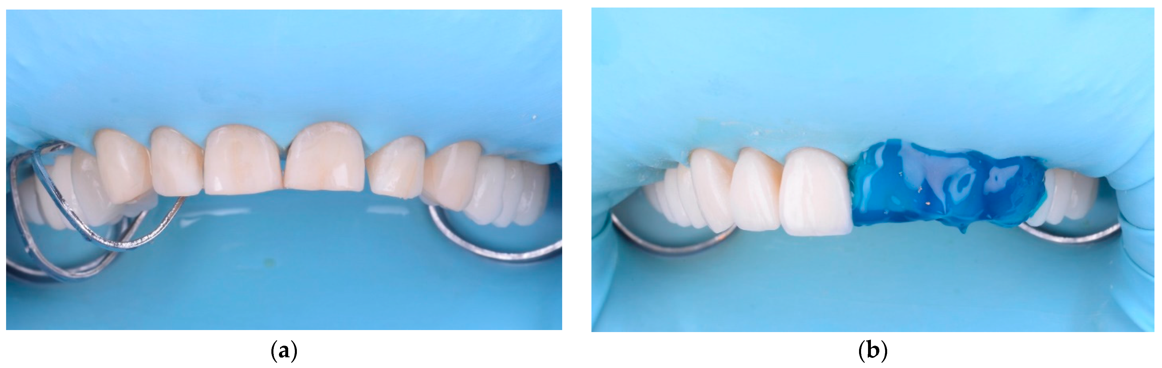 Materials 15 02150 g009a