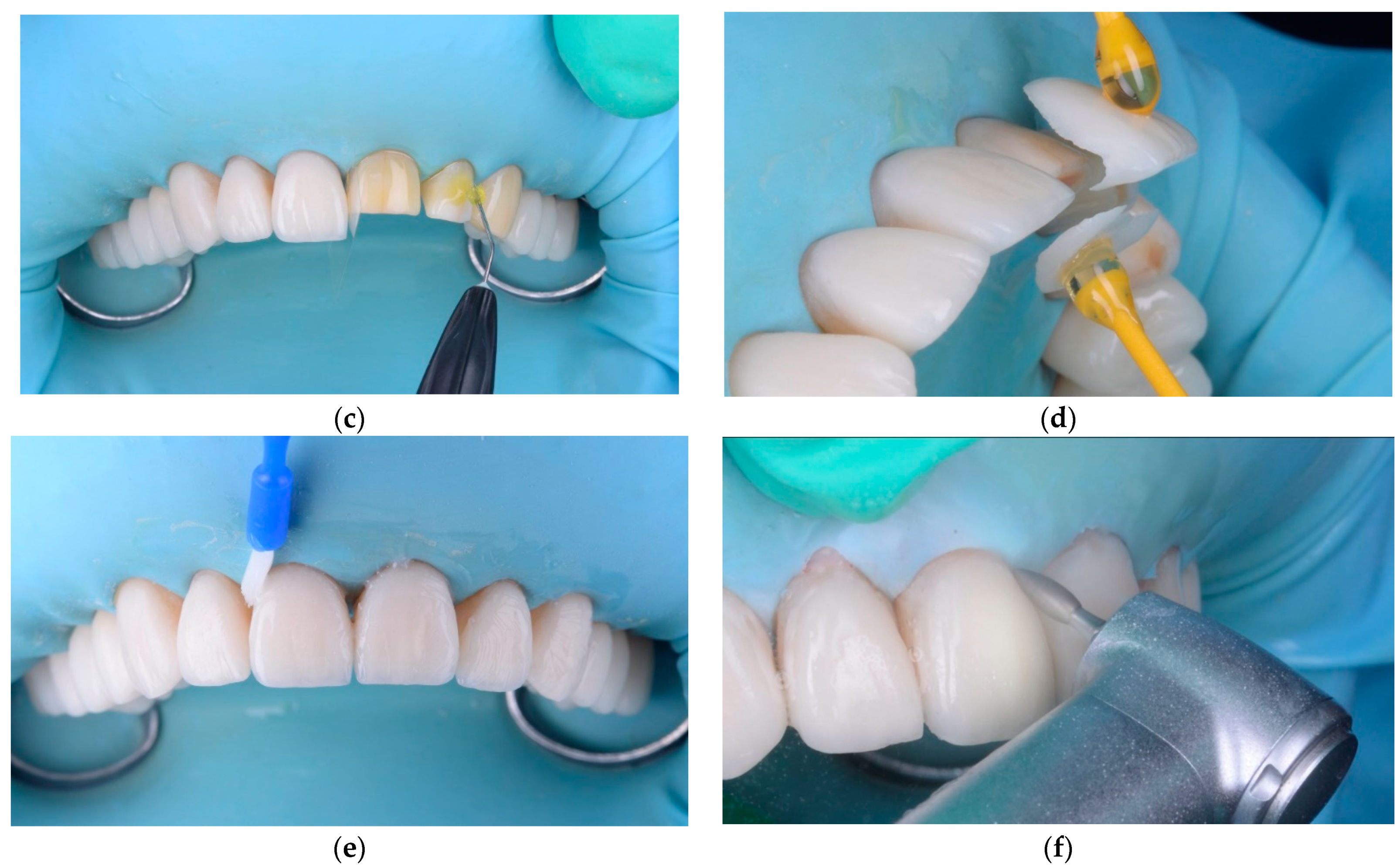 Materials 15 02150 g009b