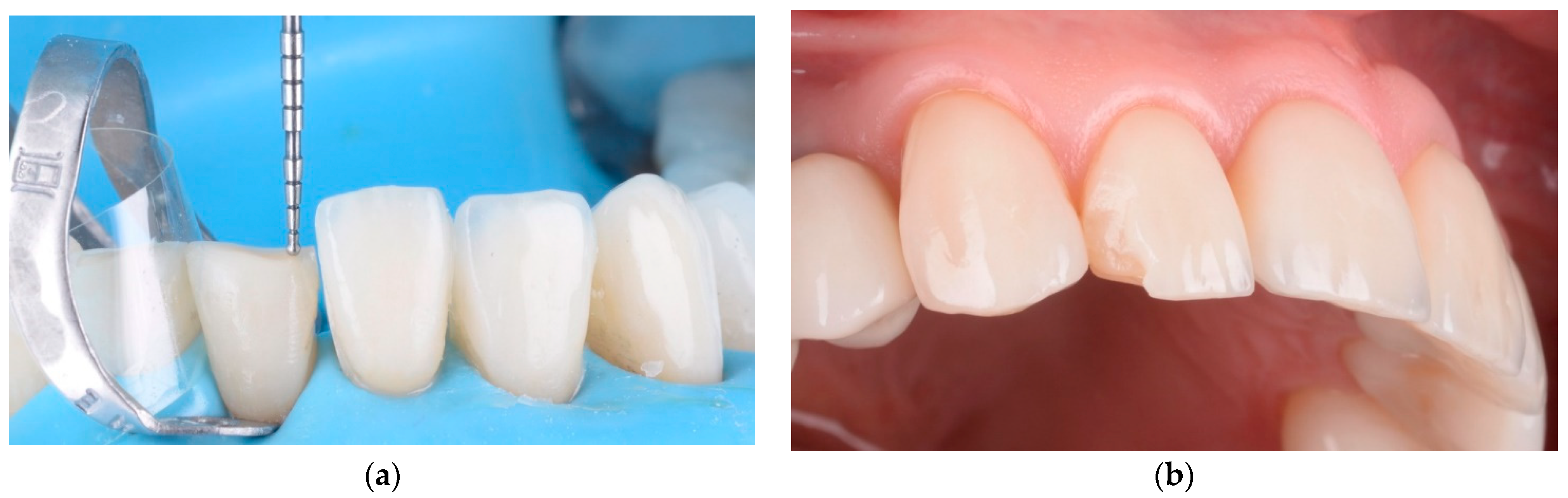 Materials 15 02150 g011