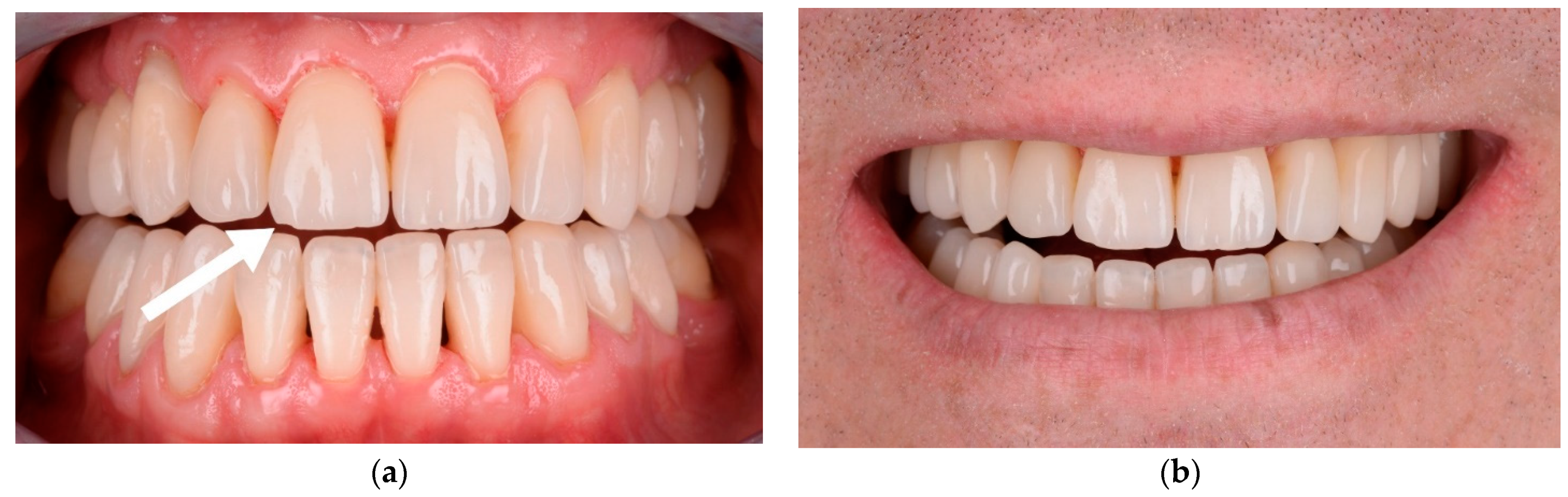 Materials 15 02150 g012