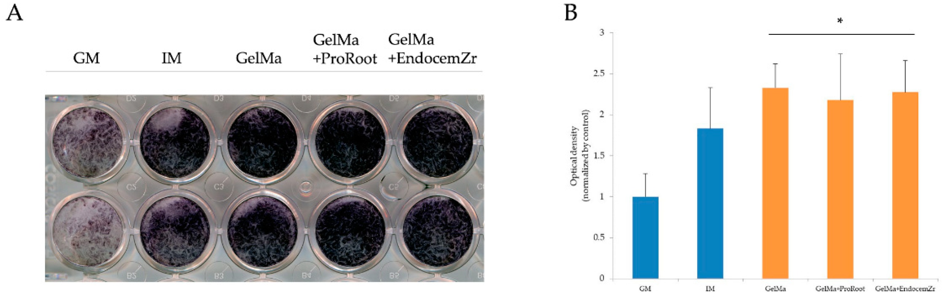 Materials 15 02170 g006