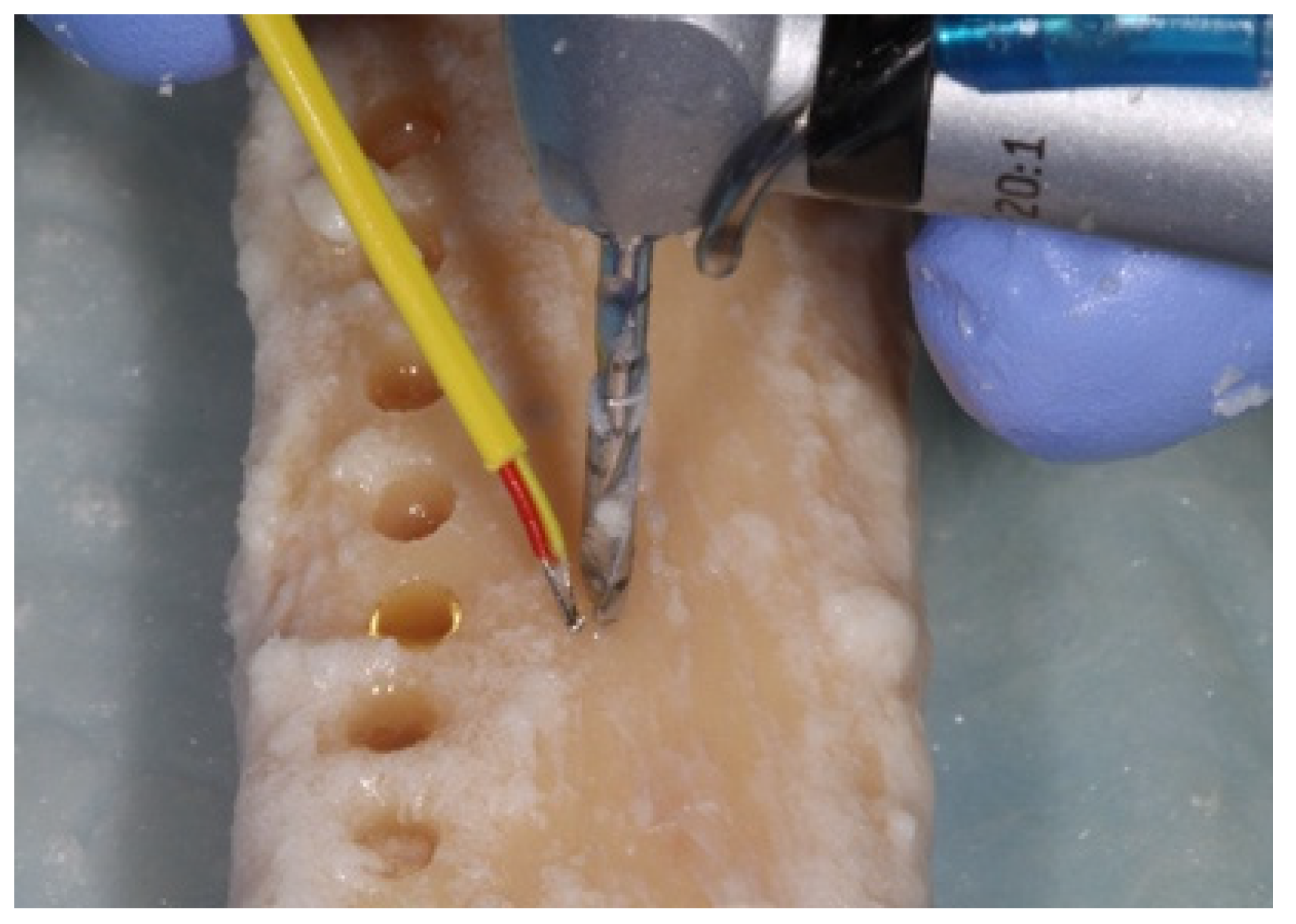 Materials 15 02369 g006 550