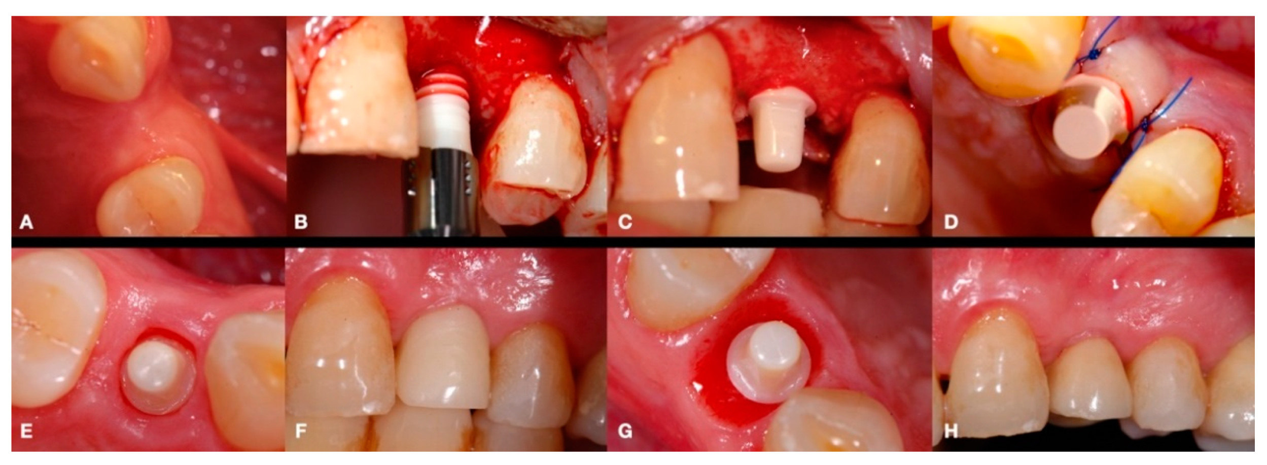 Materials 15 02437 g001 550