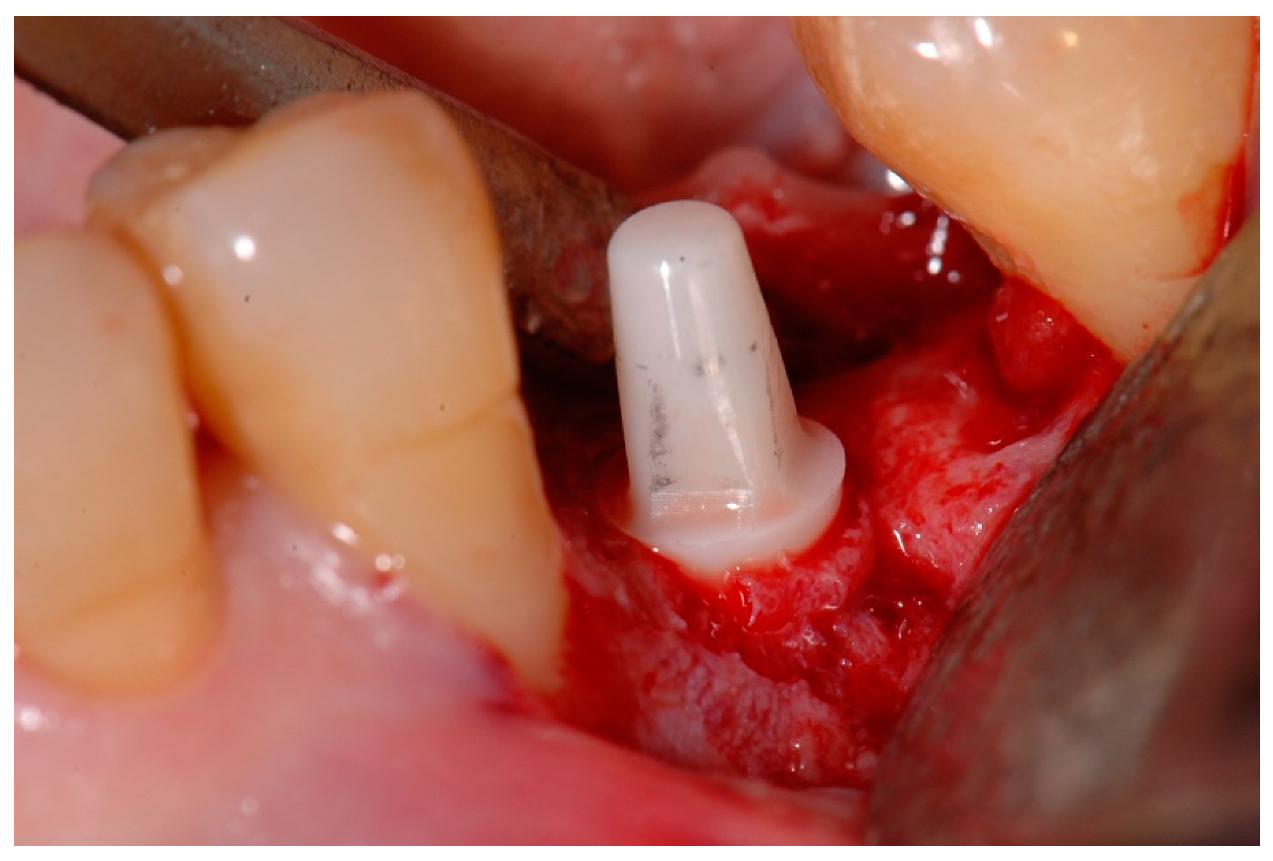 Materials 15 02437 g002 550