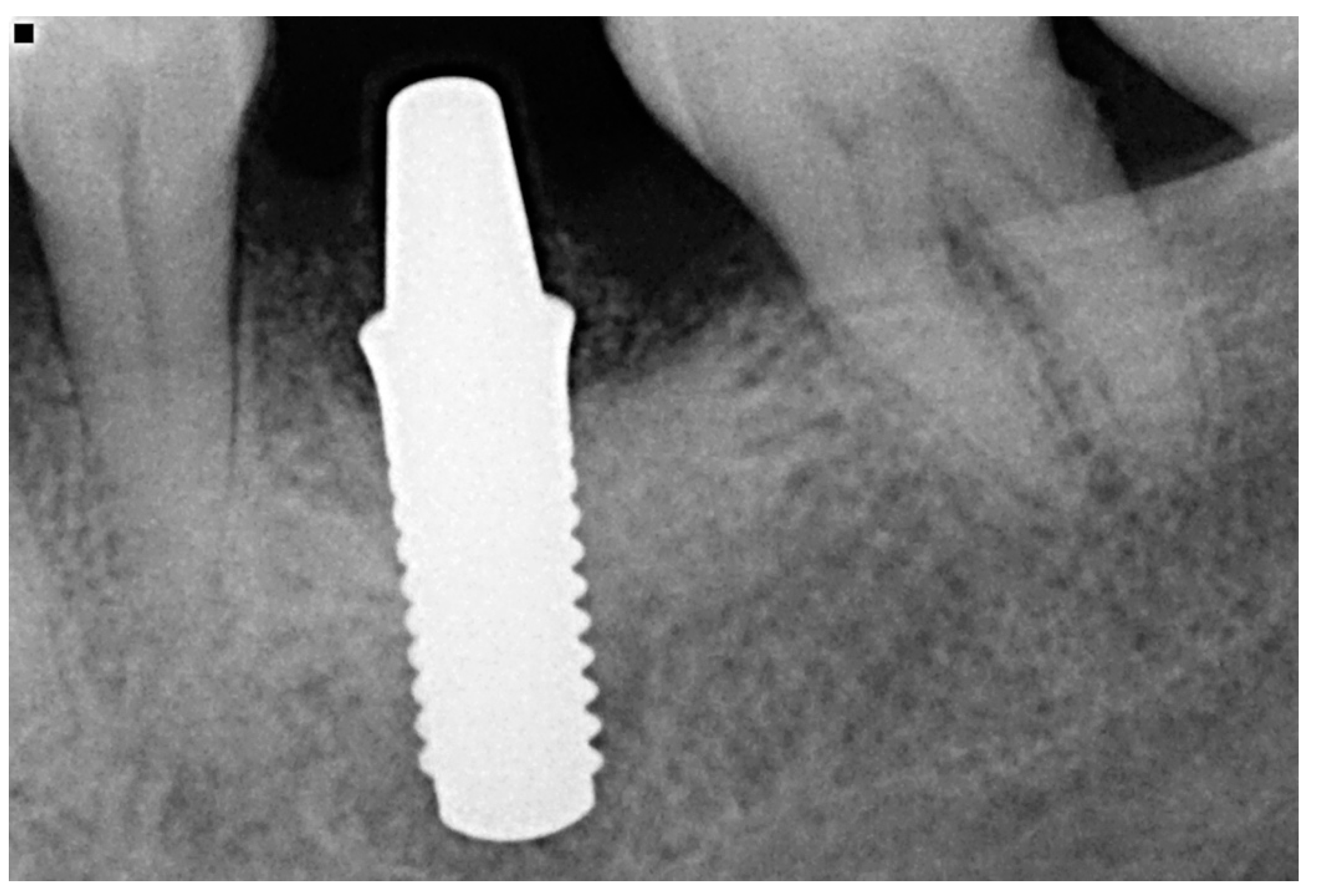 Materials 15 02437 g003 550