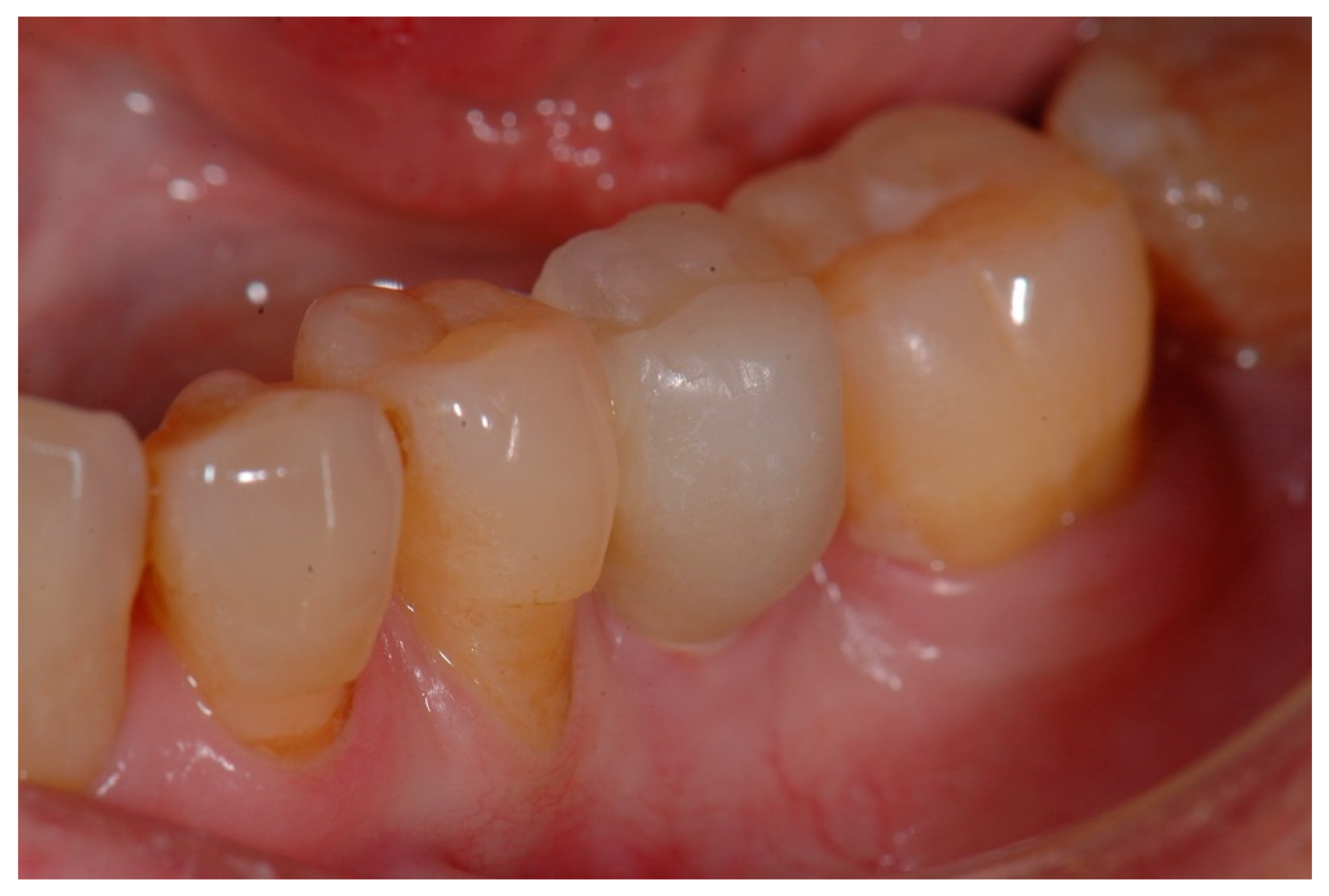 Materials 15 02437 g004 550