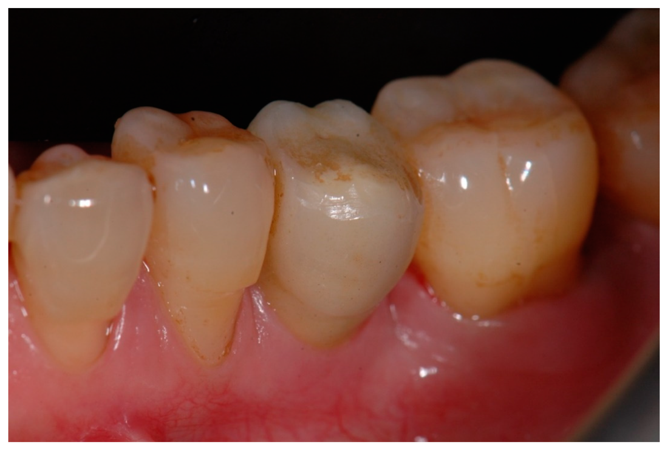 Materials 15 02437 g005 550