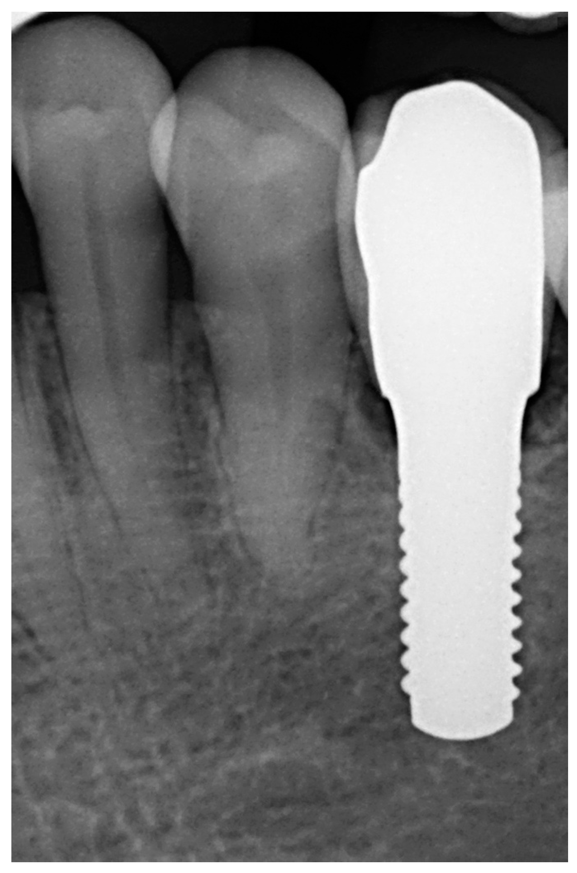 Materials 15 02437 g006 550