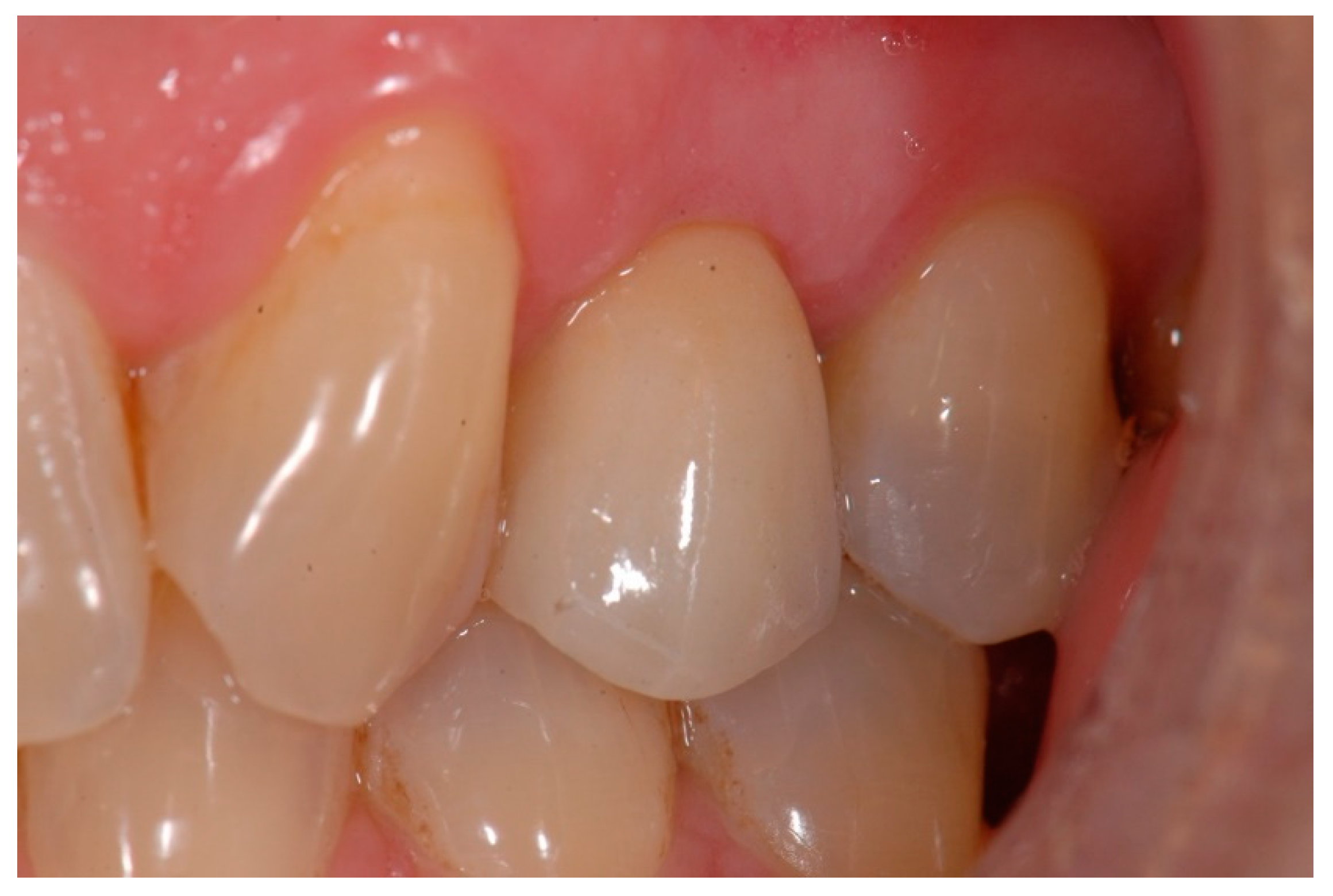 Materials 15 02437 g007 550