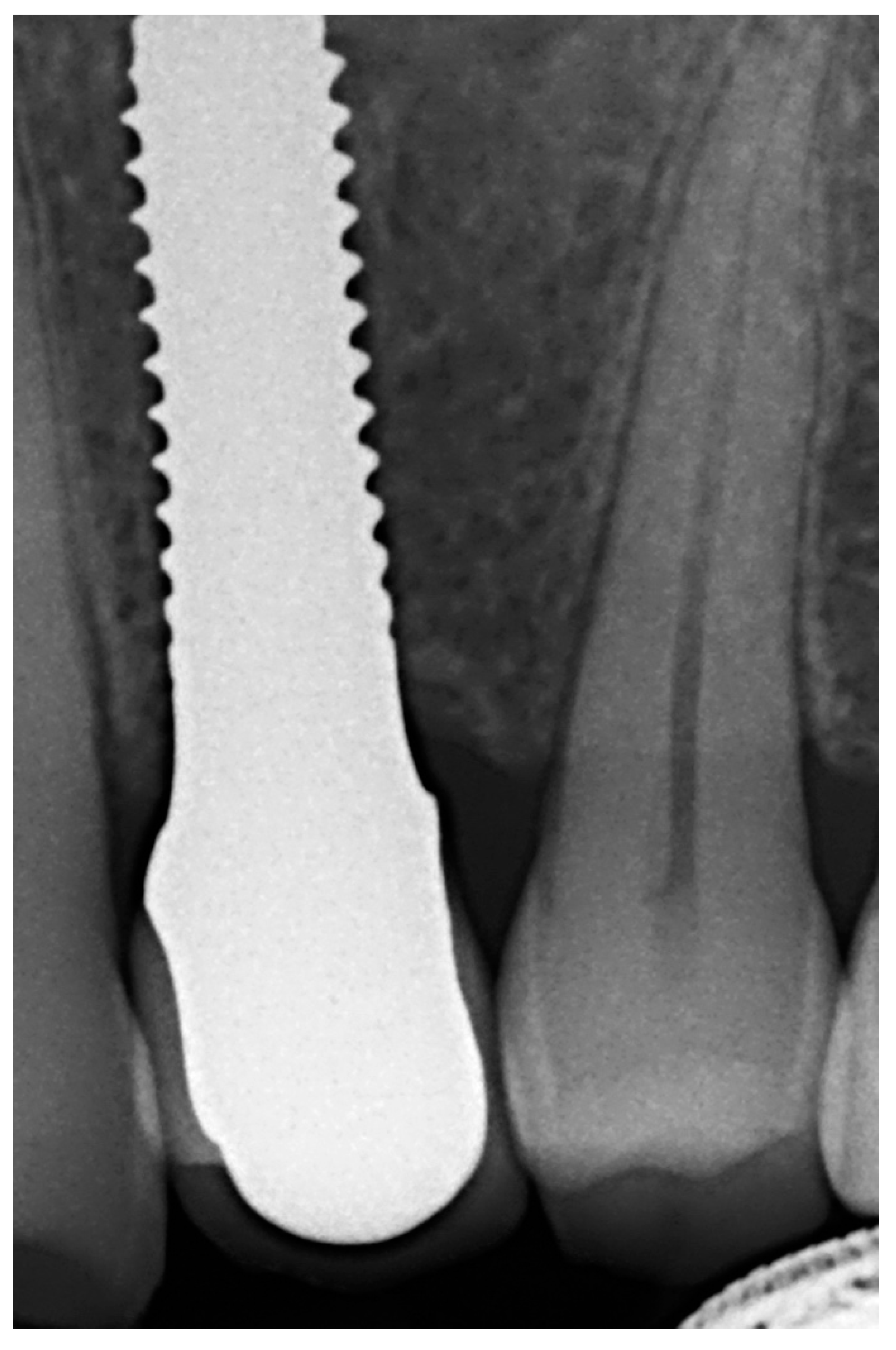 Materials 15 02437 g008 550