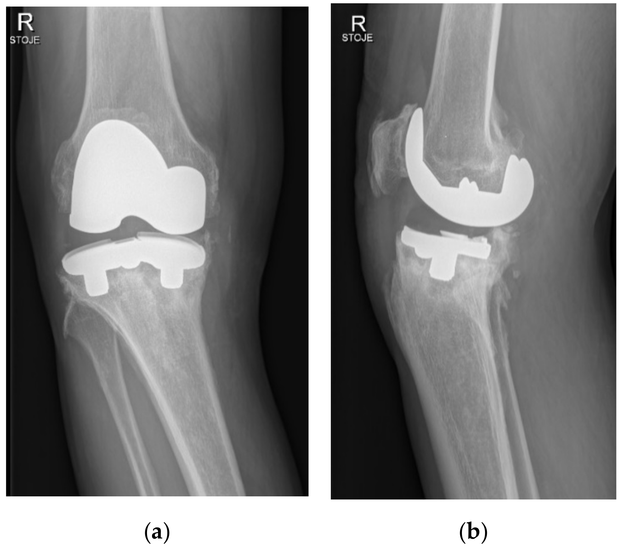 Materials 15 02575 g002 550