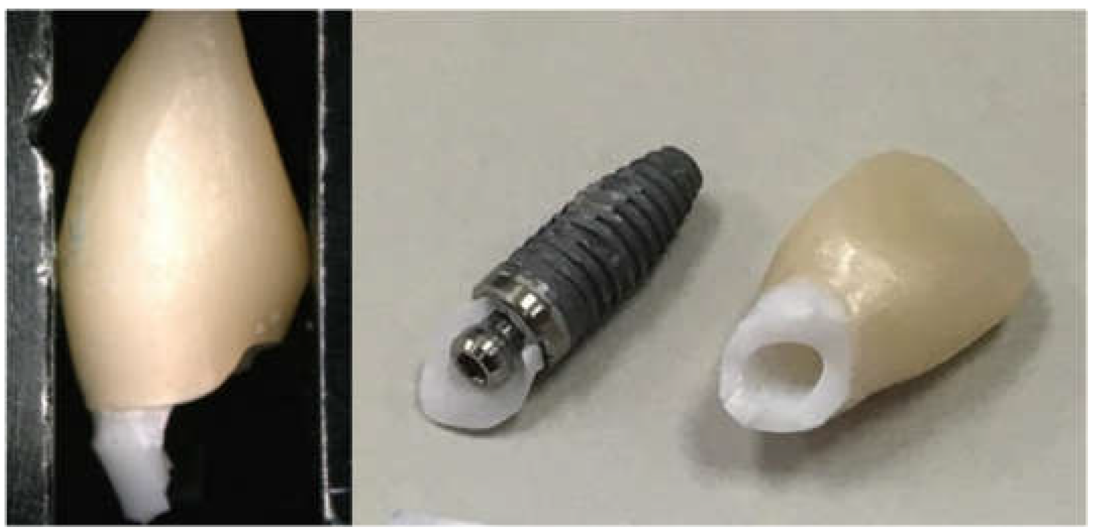 Materials 15 02656 g006