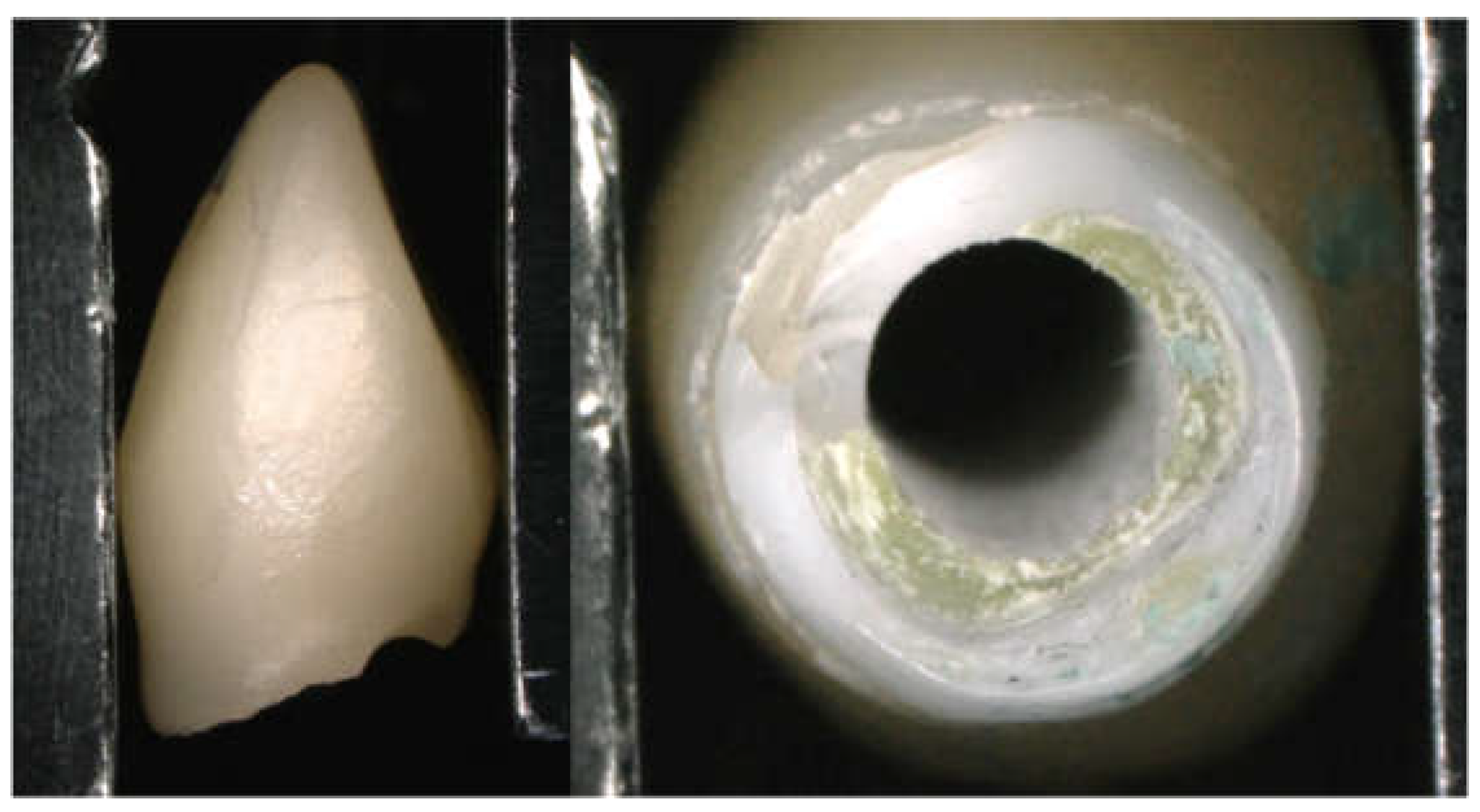 Materials 15 02656 g008