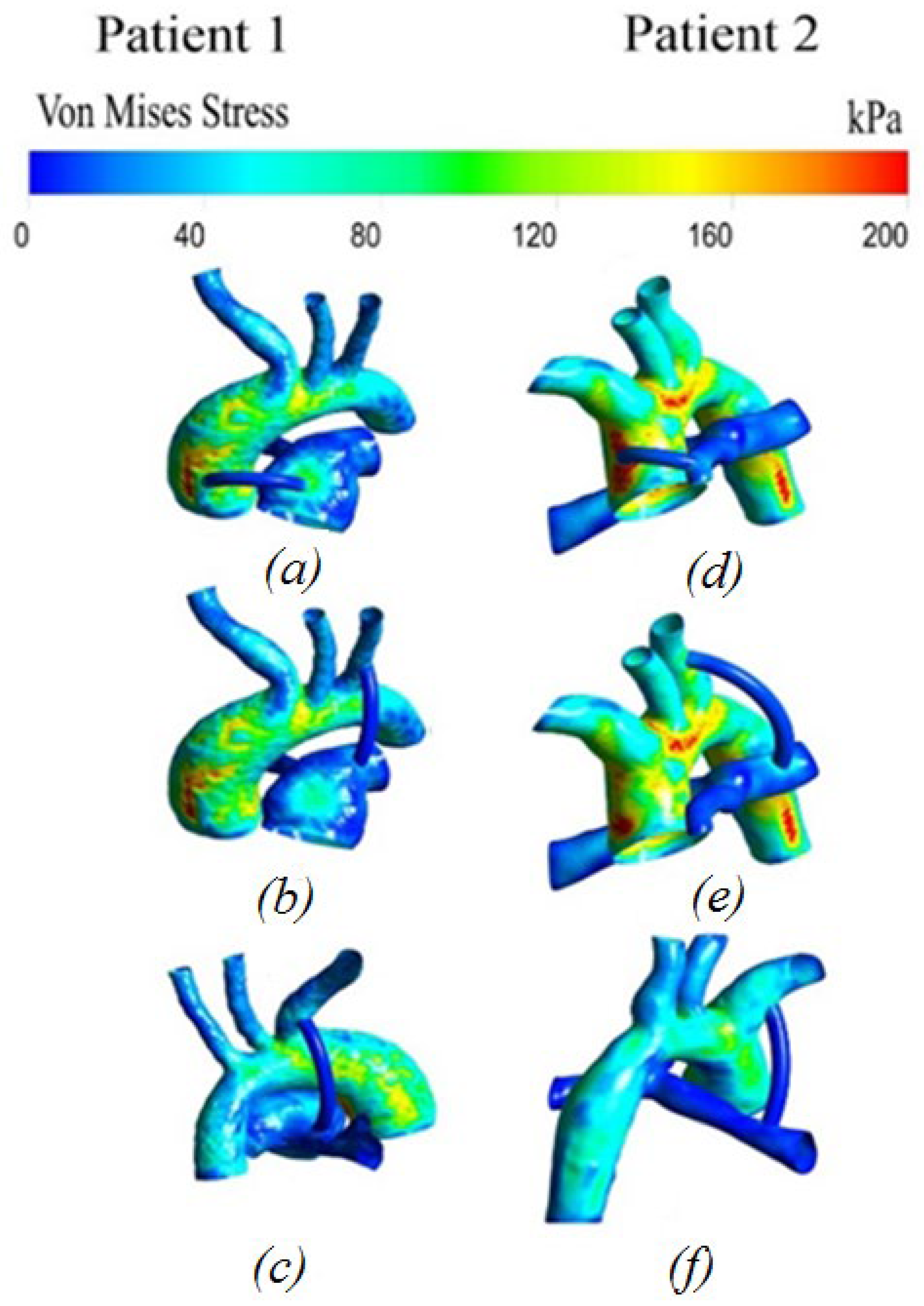 Materials 15 02719 g011