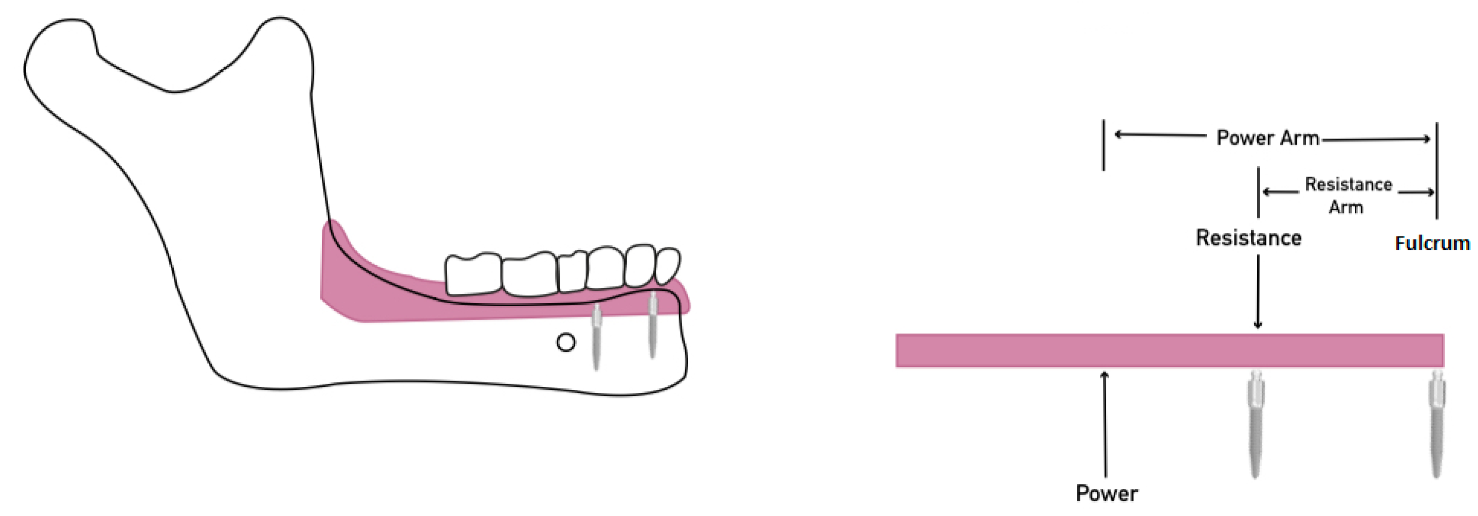 Materials 15 02988 g004 550