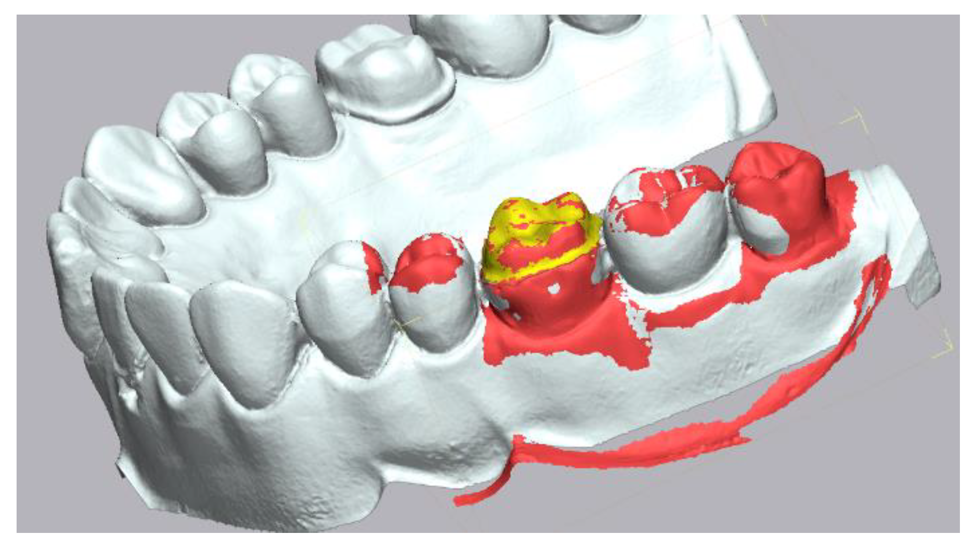 Materials 15 03061 g003 550