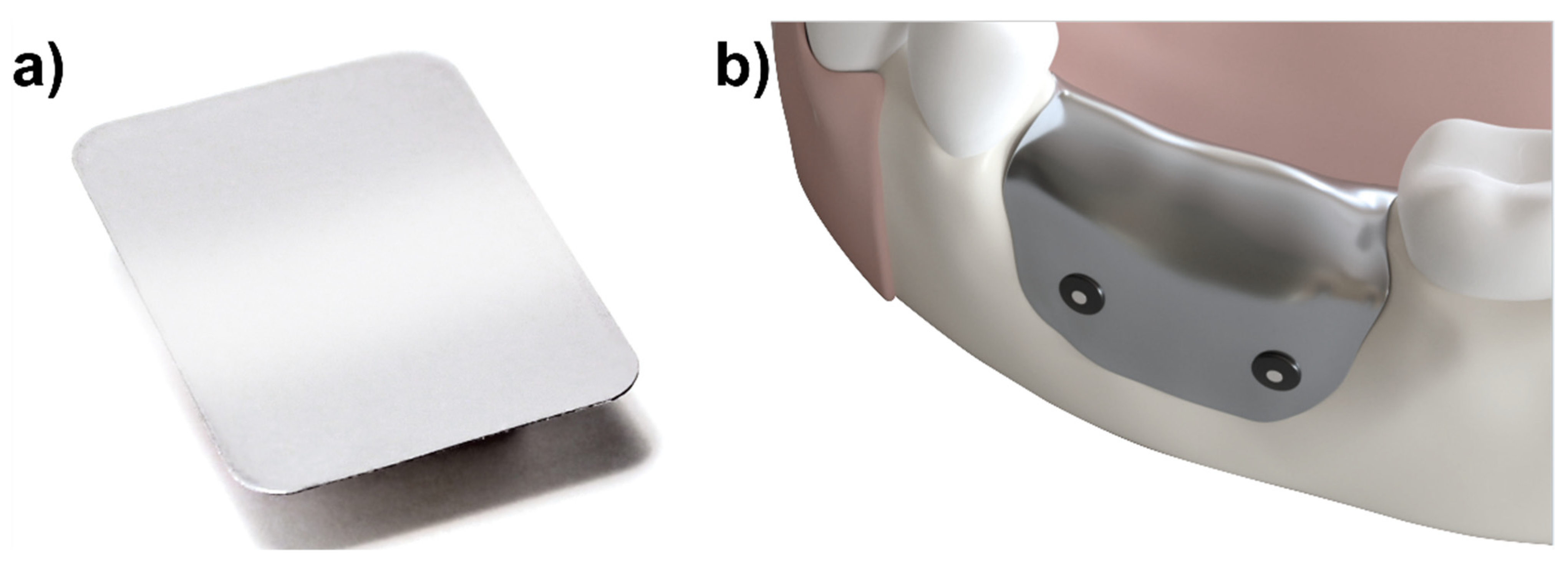 Materials 15 03106 g001 550