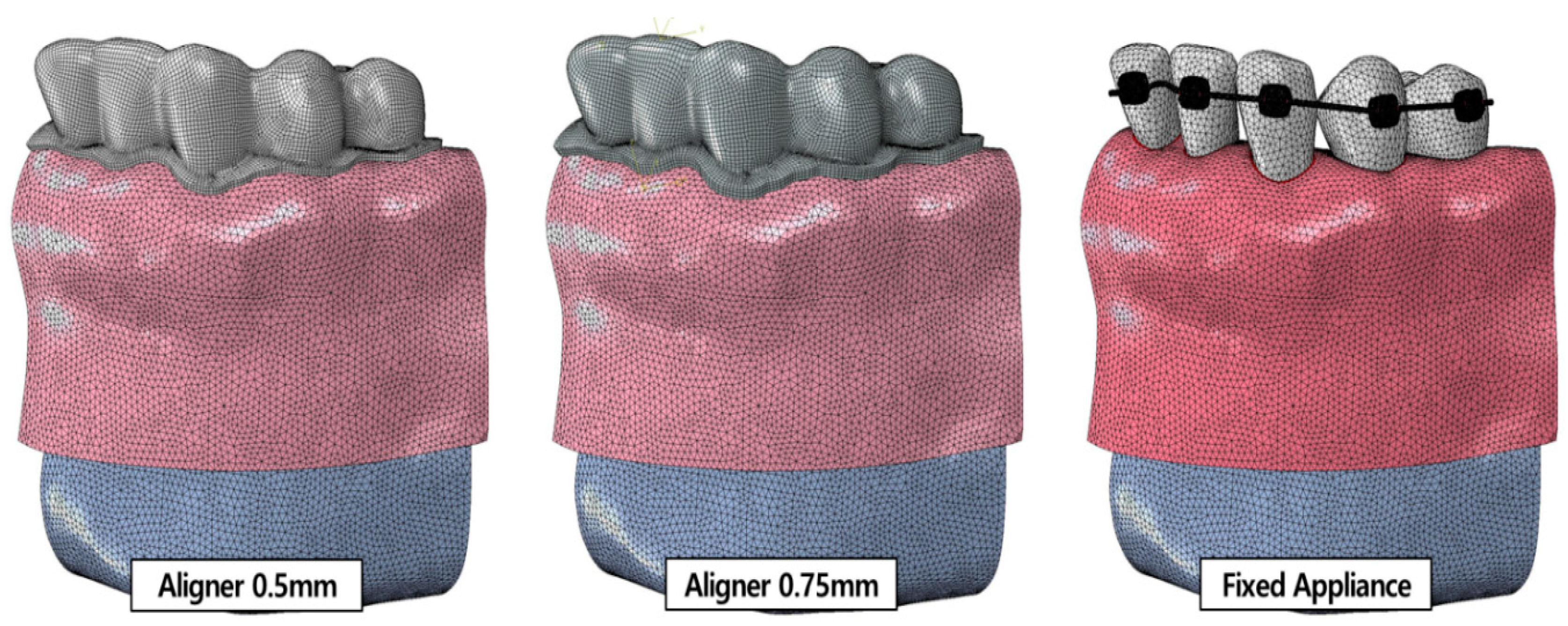 Materials 15 03118 g005
