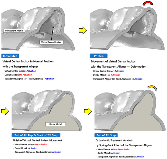 健康・医学 267 Aligner Orthodontics and Orofacial 健康・医学 267 Aligner Orthodontics and Orofacial Aligner